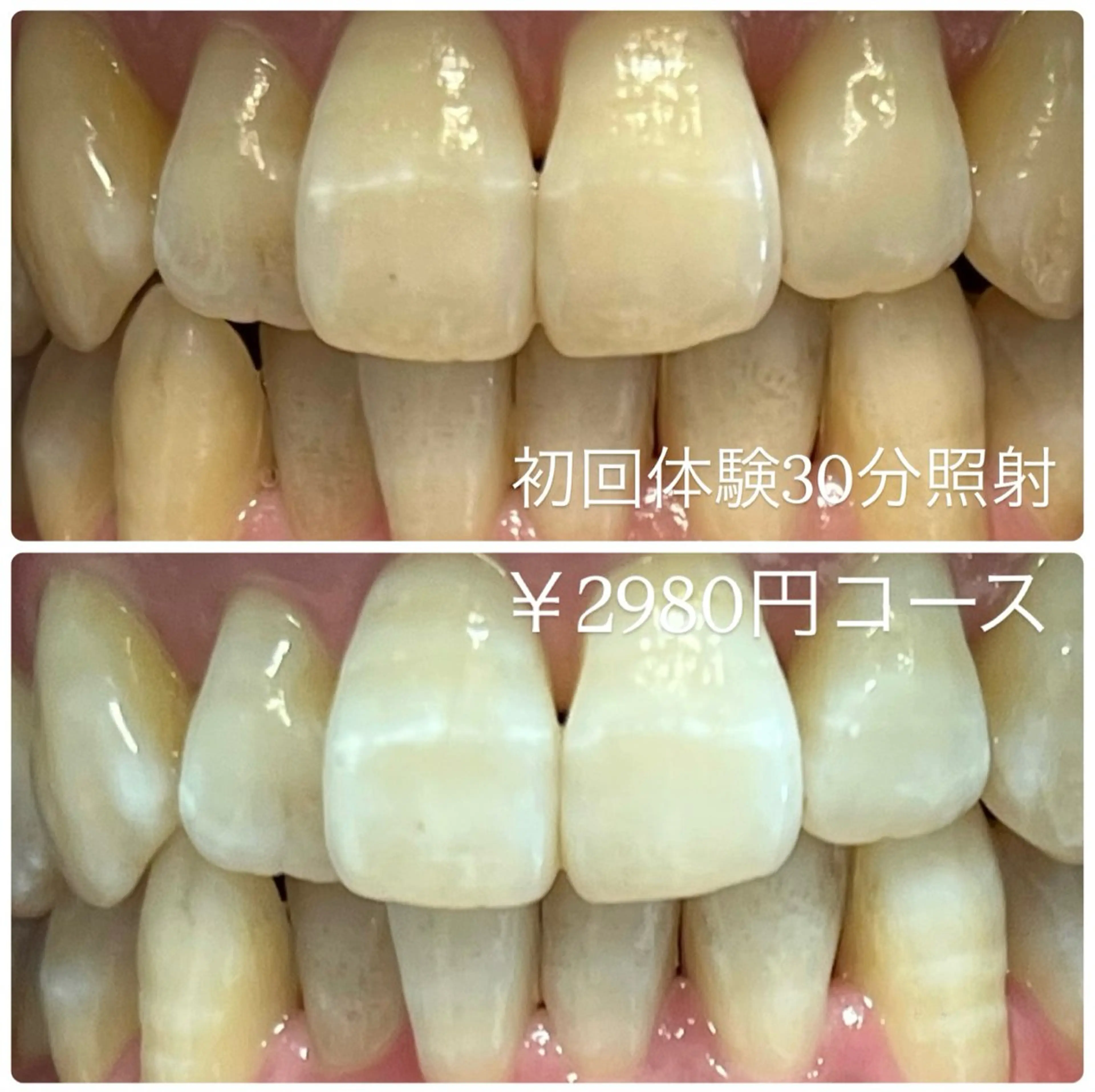 その他 PLATINUM Beauty 横浜店所属・ホワイトニングルーム 横浜店のその他イメージ