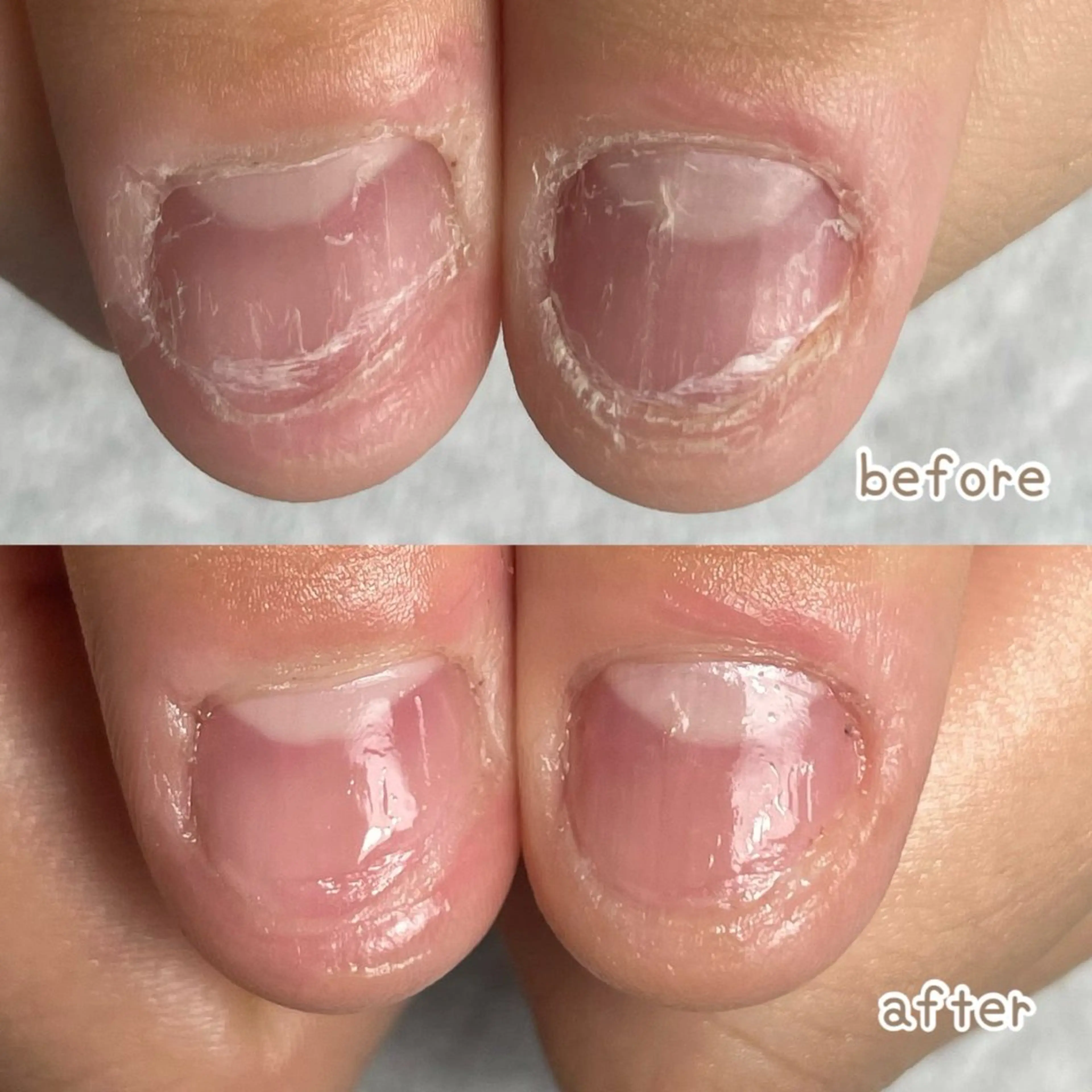 ネイル ハンドケア 高木 みどりのネイルデザイン