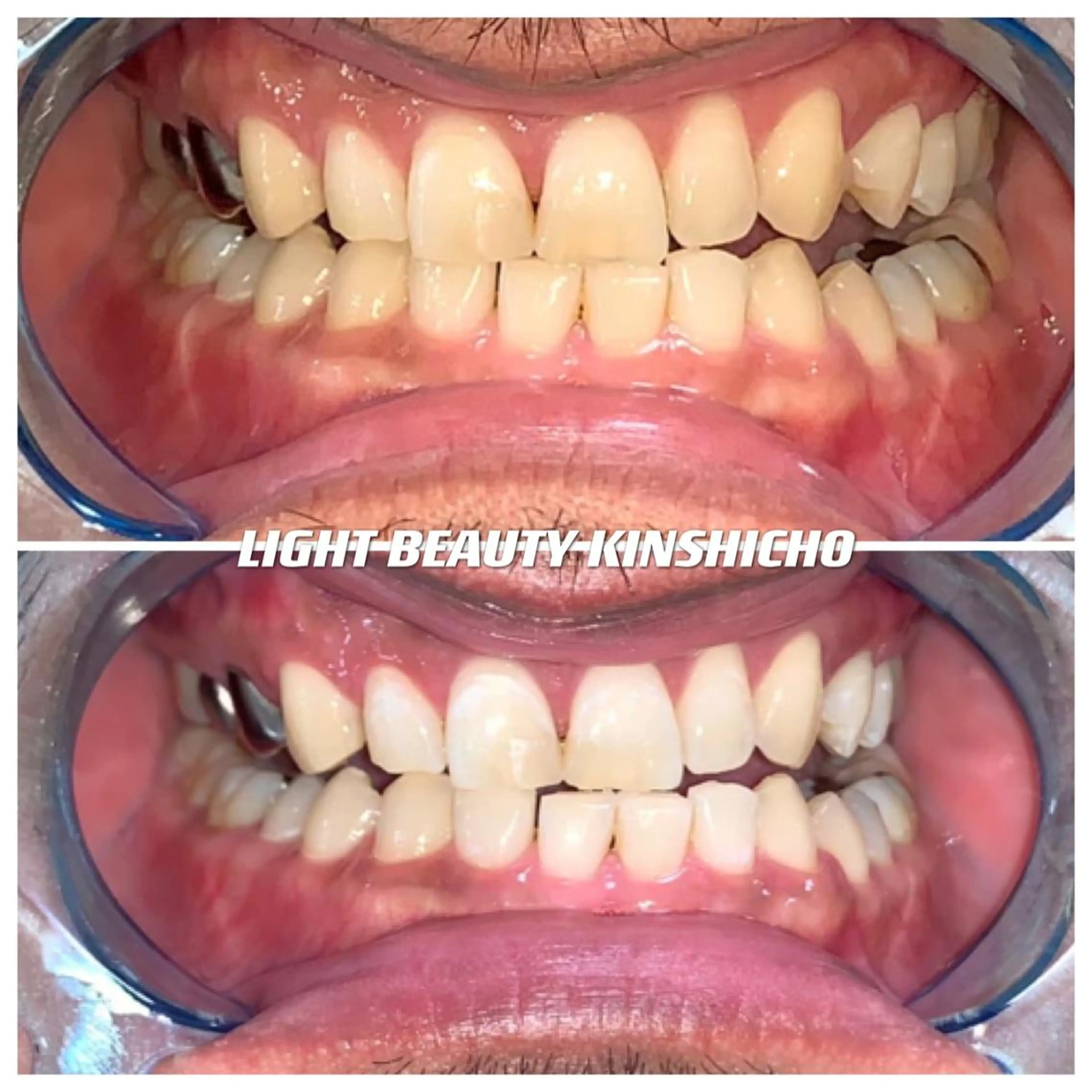 ライトビューティー 錦糸町店のエステ・リラクイメージ