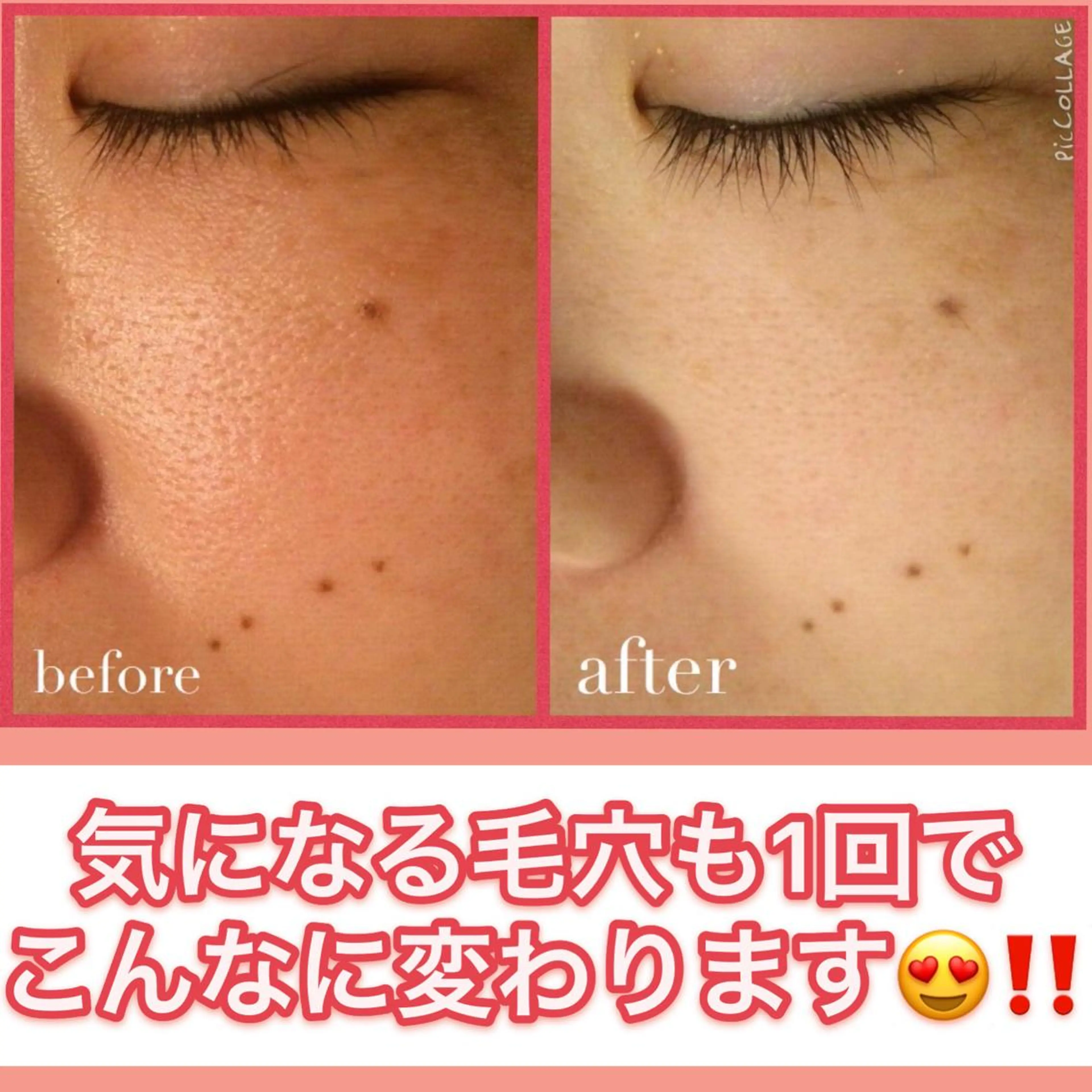 ミディアム カラー パーマ ヘアアレンジ メンズ キッズ ネイル マツエク・マツパ ニキビ・肌質改善専門 ♡人生が変わるサロンのエステ・リラクイメージ