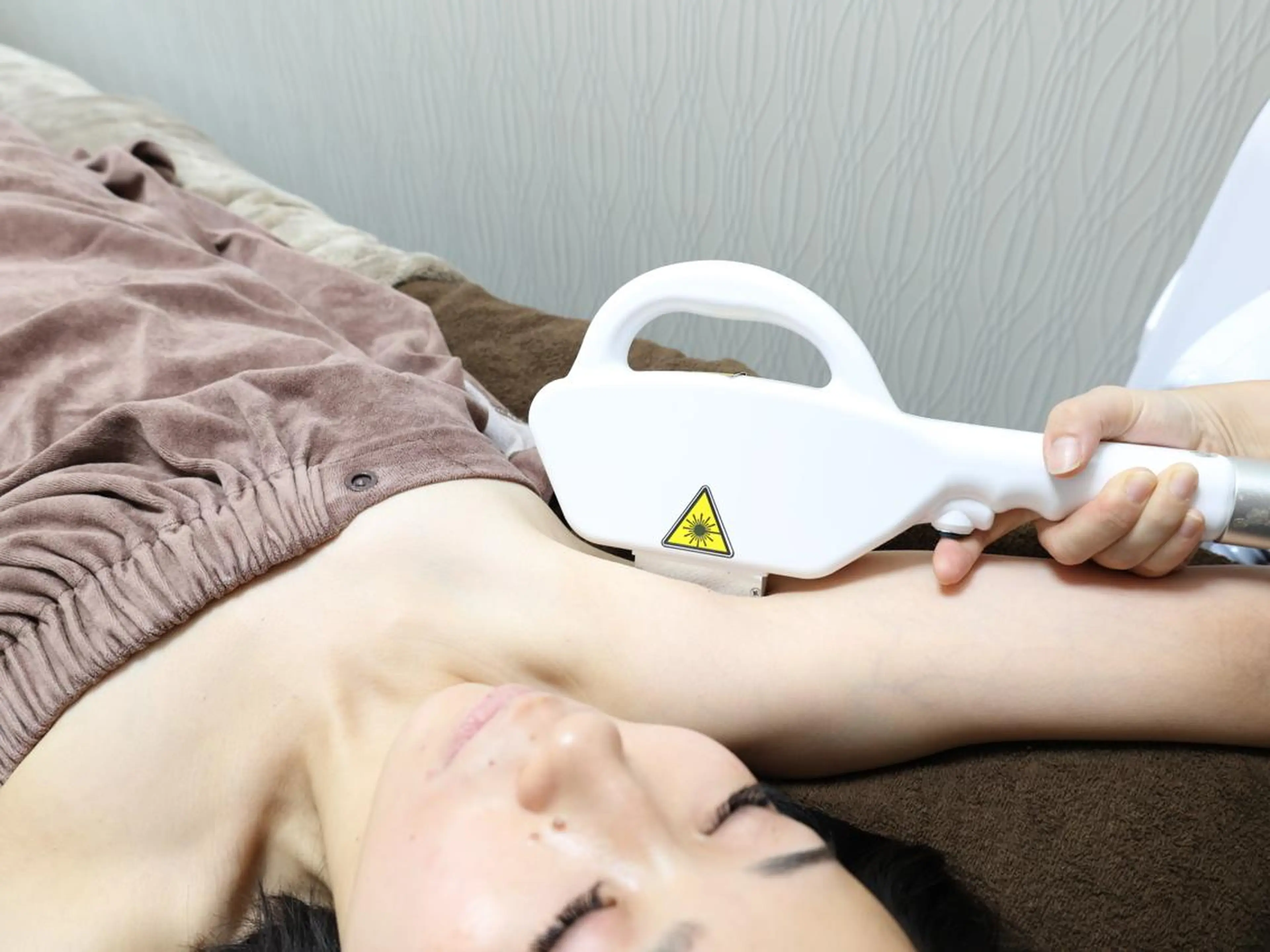 美肌脱毛　ワキの写真