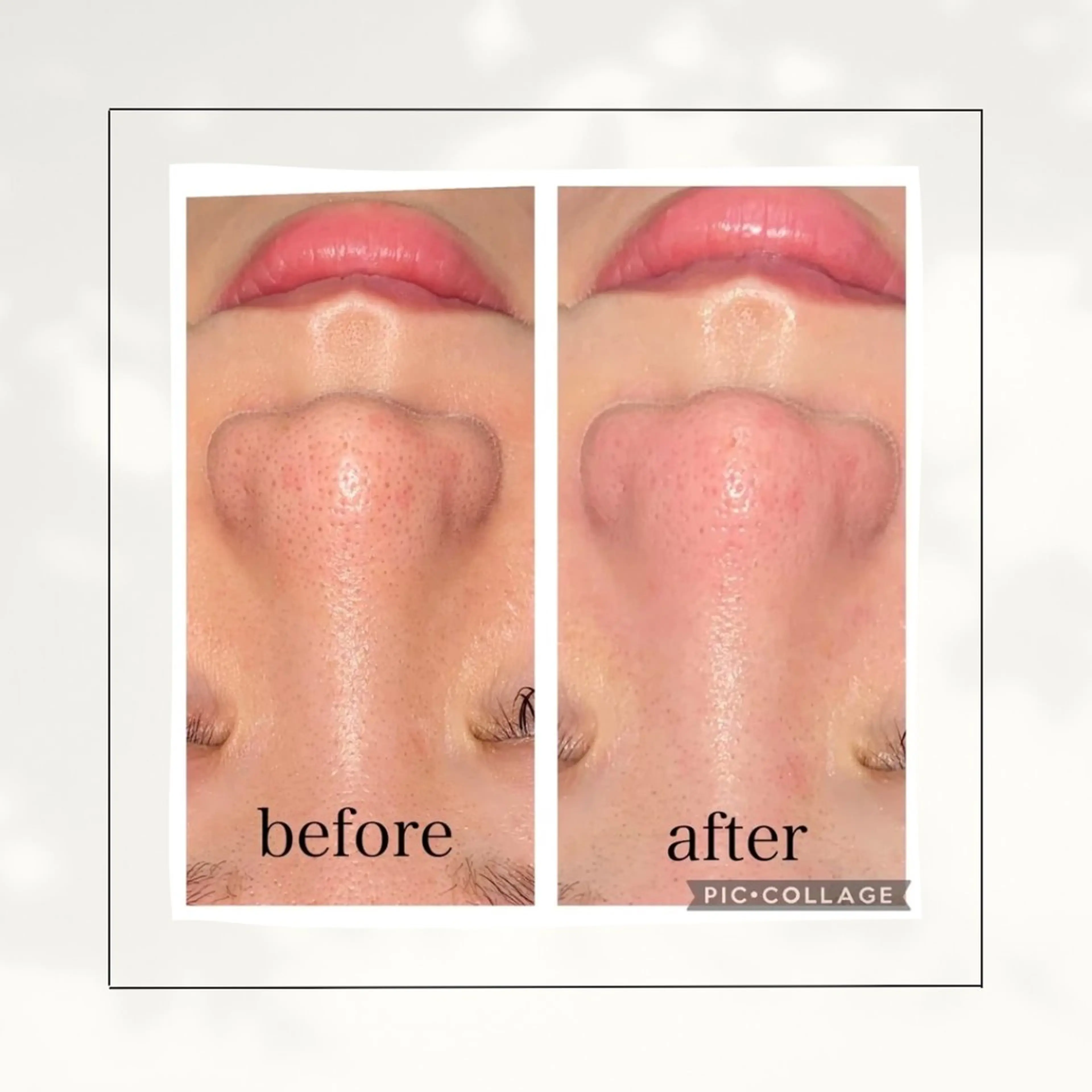 エステ シミ・毛穴専門店 gracia 宇土店所属・シミ・毛穴専門店 /gracia 安藤のエステ・リラクイメージ