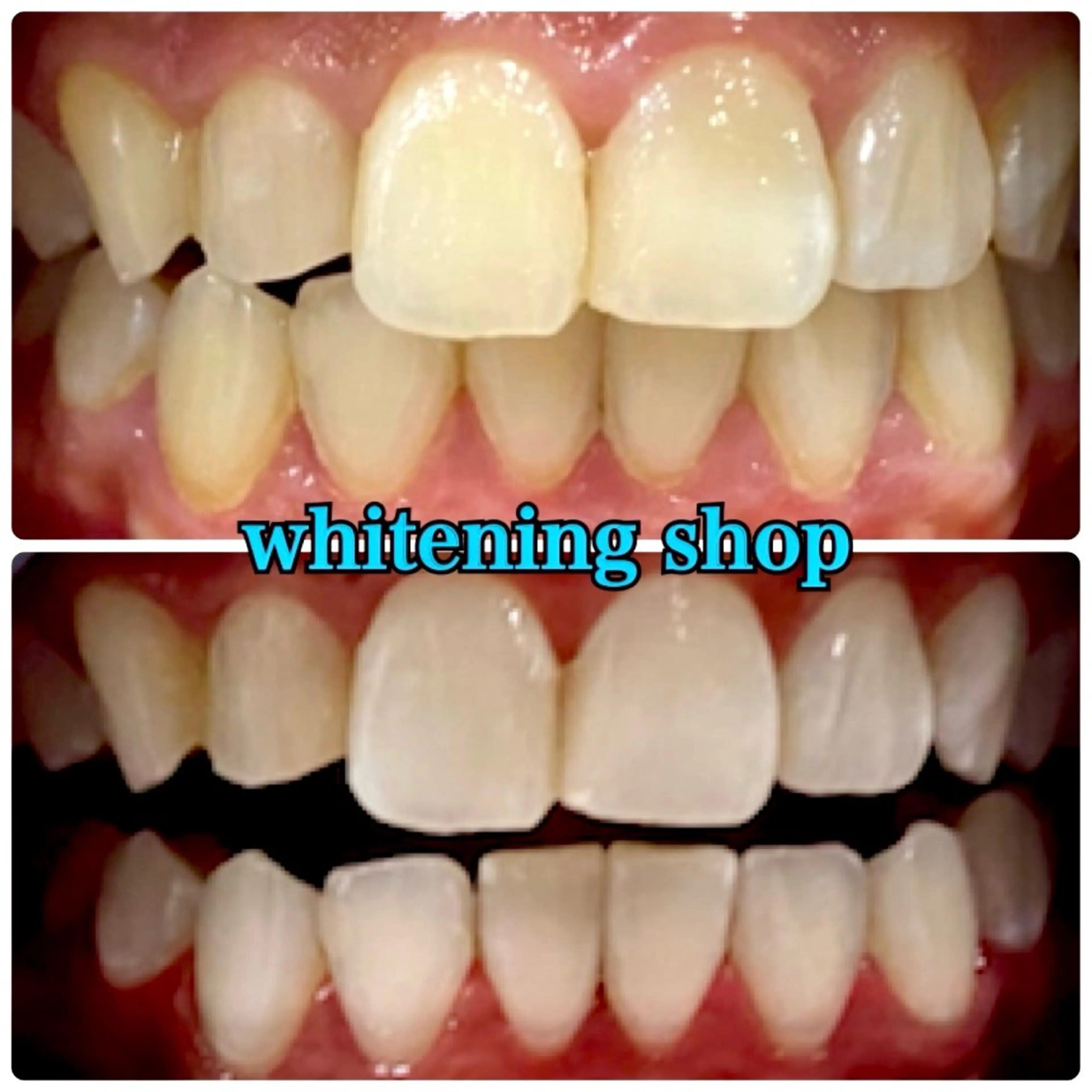 メンズ エステ リラク ホワイトニング ショップ川越店のエステ・リラクイメージ