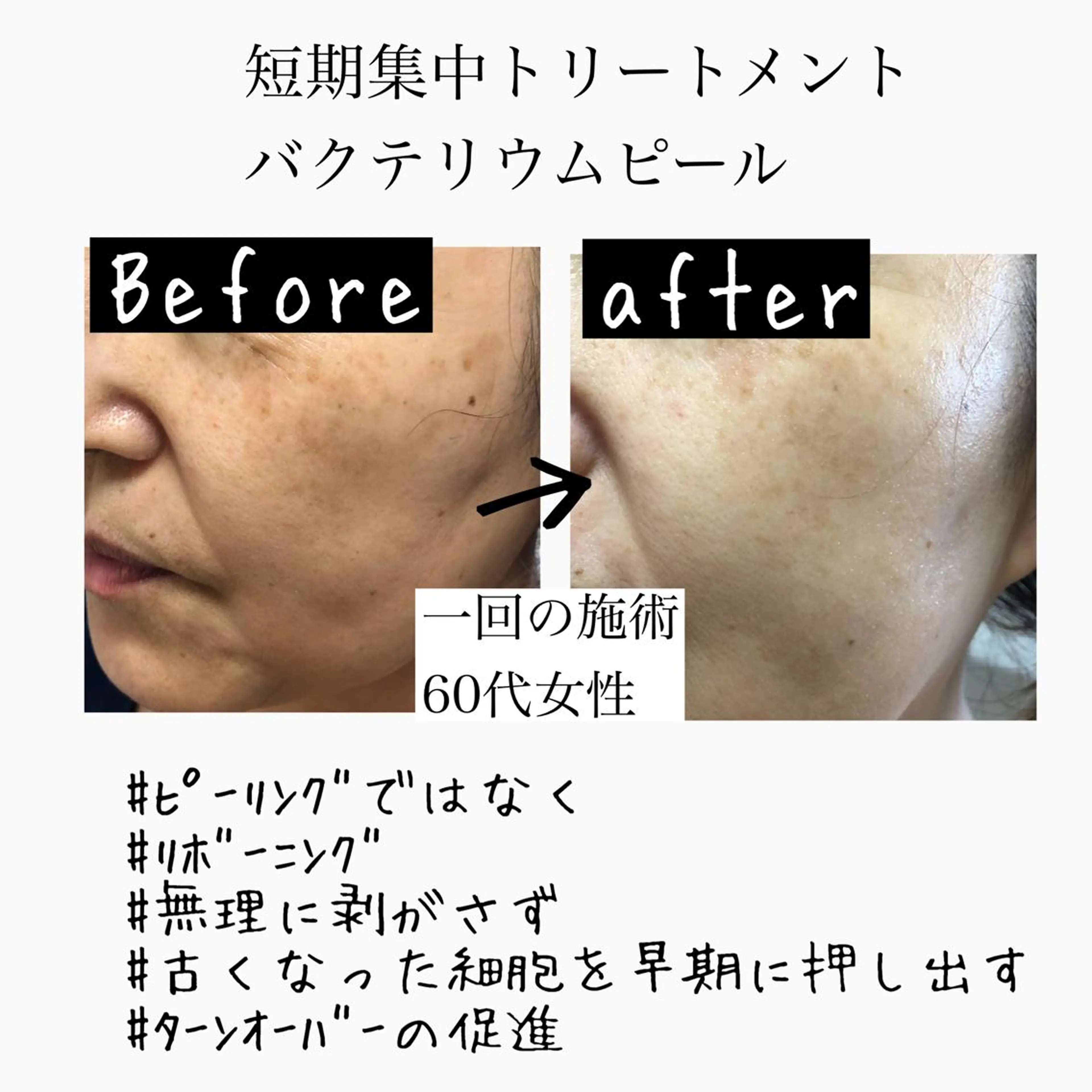 美肌脱毛と癒しのﾌﾟﾗｲﾍﾞｰﾄｻﾛﾝ。gratia~ｸﾞﾚｲﾃｨｱ~所属・gratia ~ｸﾞﾚｲﾃｨｱ~のエステ・リラクイメージ