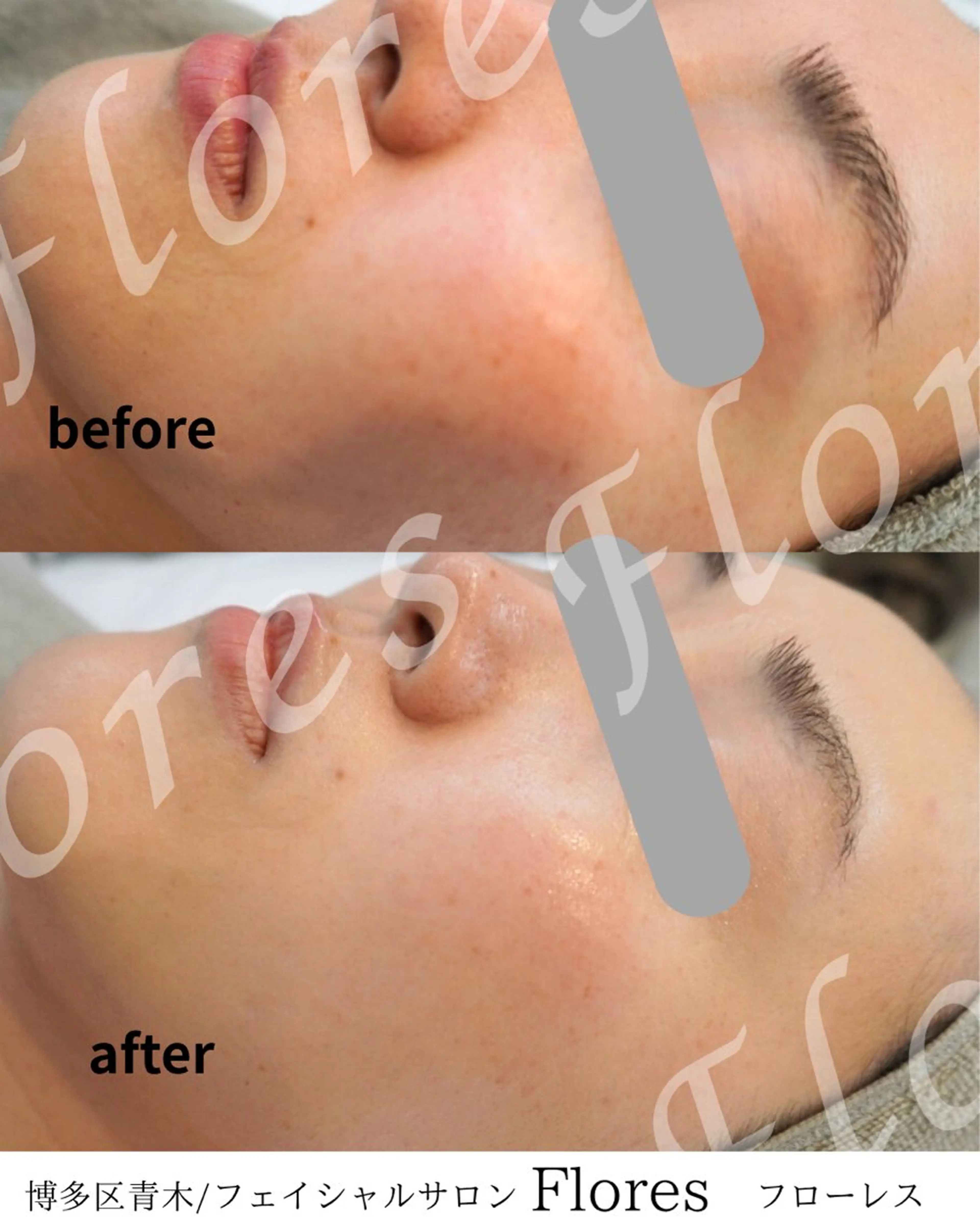 Flores所属・Flores- フローレスのエステ・リラクイメージ