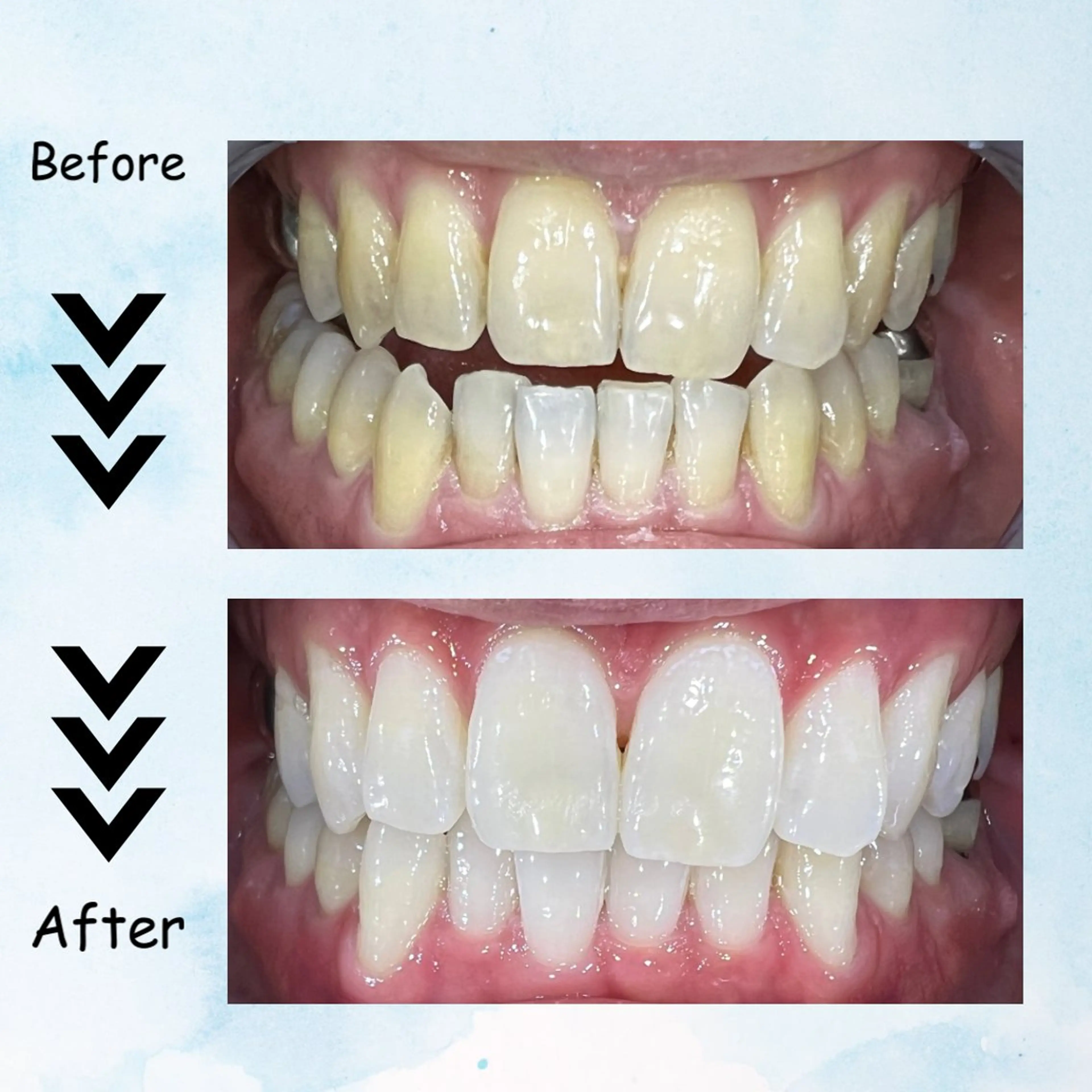 メンズ その他 セルフホワイトニング エクシア塩釜口駅前店所属・セルフホワイトニング エクシア塩釜口駅前店のその他イメージ