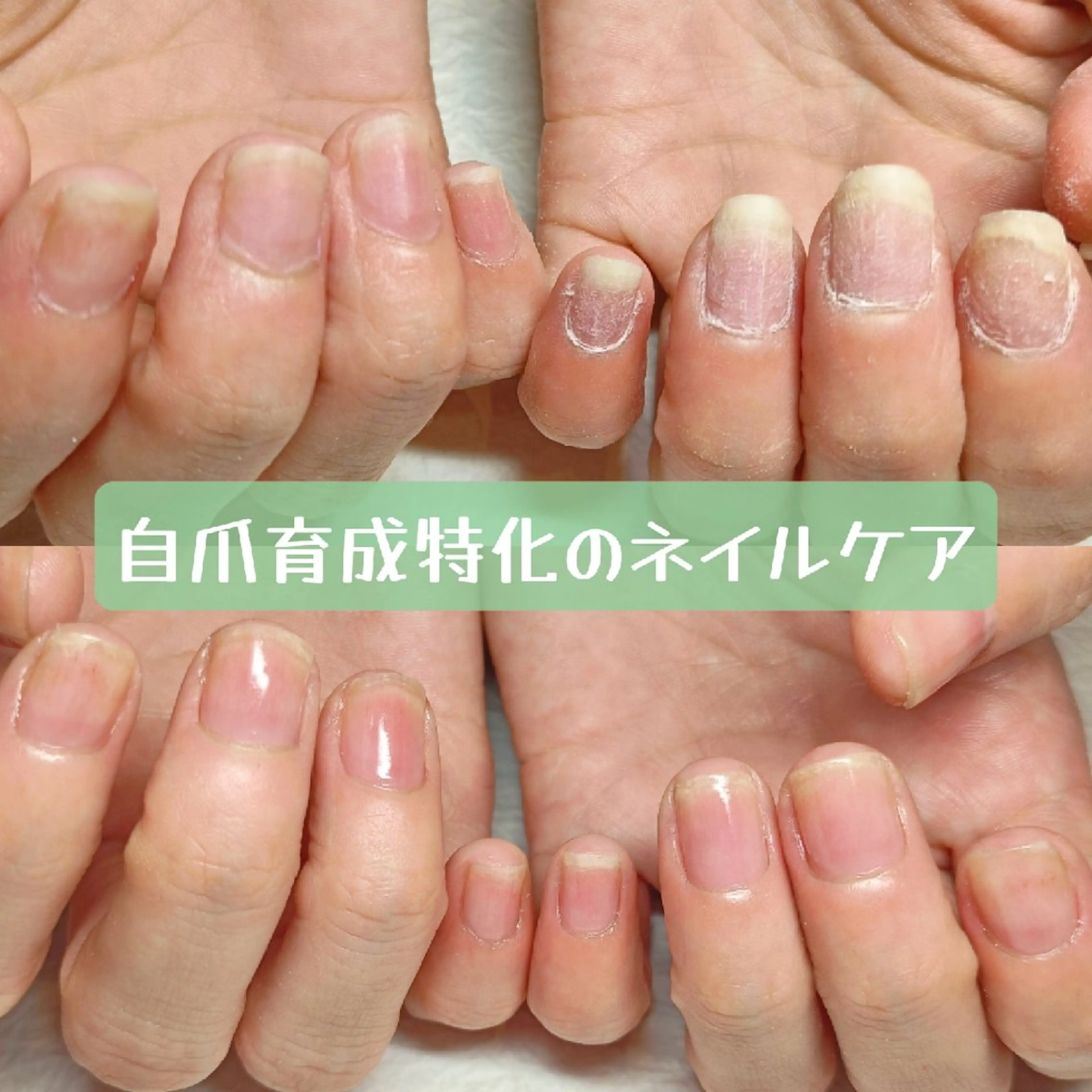 ネイル ハンドネイル ハンドケア 深爪矯正/爪育成ケア manie nailのネイルデザイン