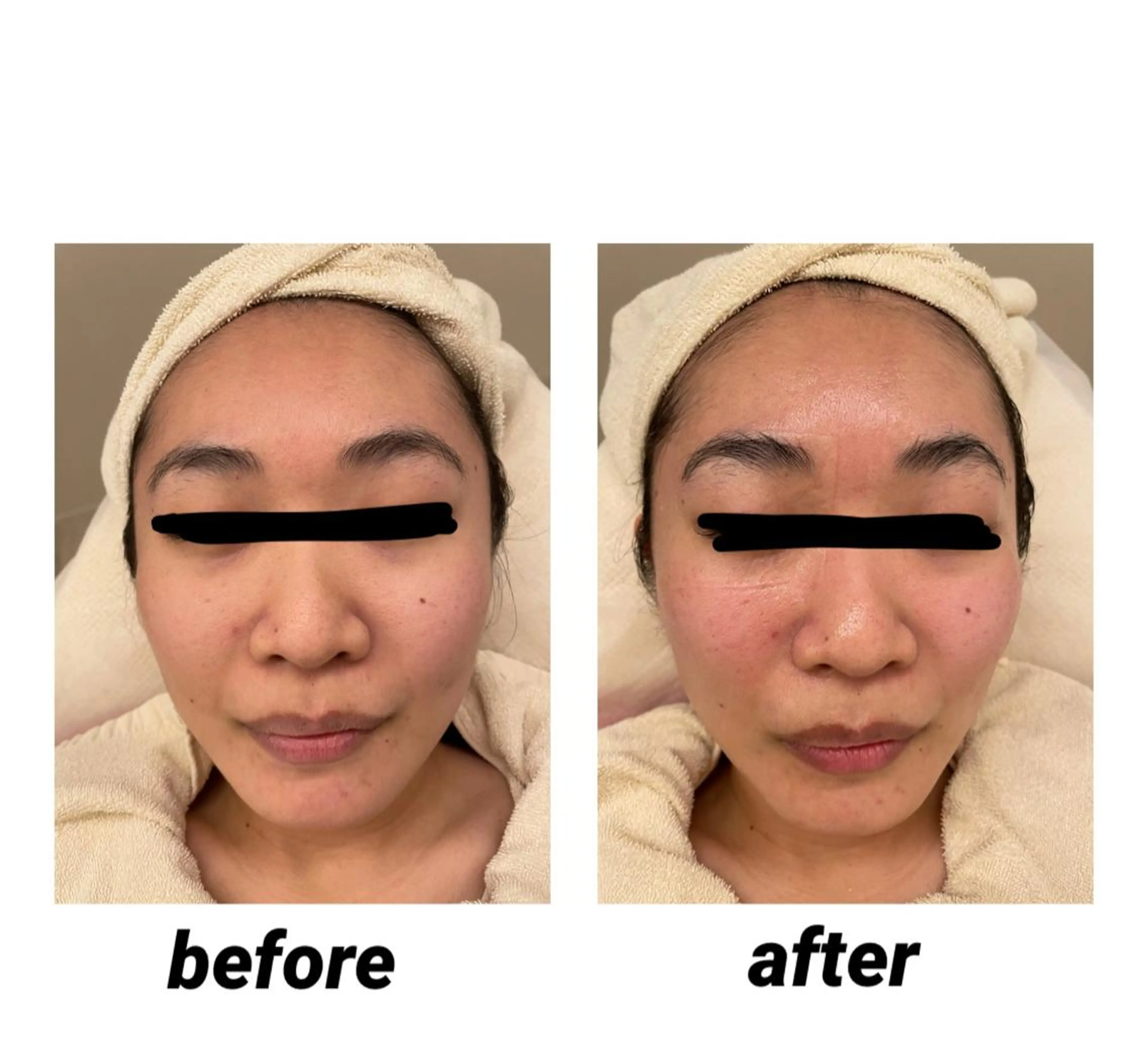 DeI'm   名古屋栄所属・小林 玲菜のエステ・リラクイメージ