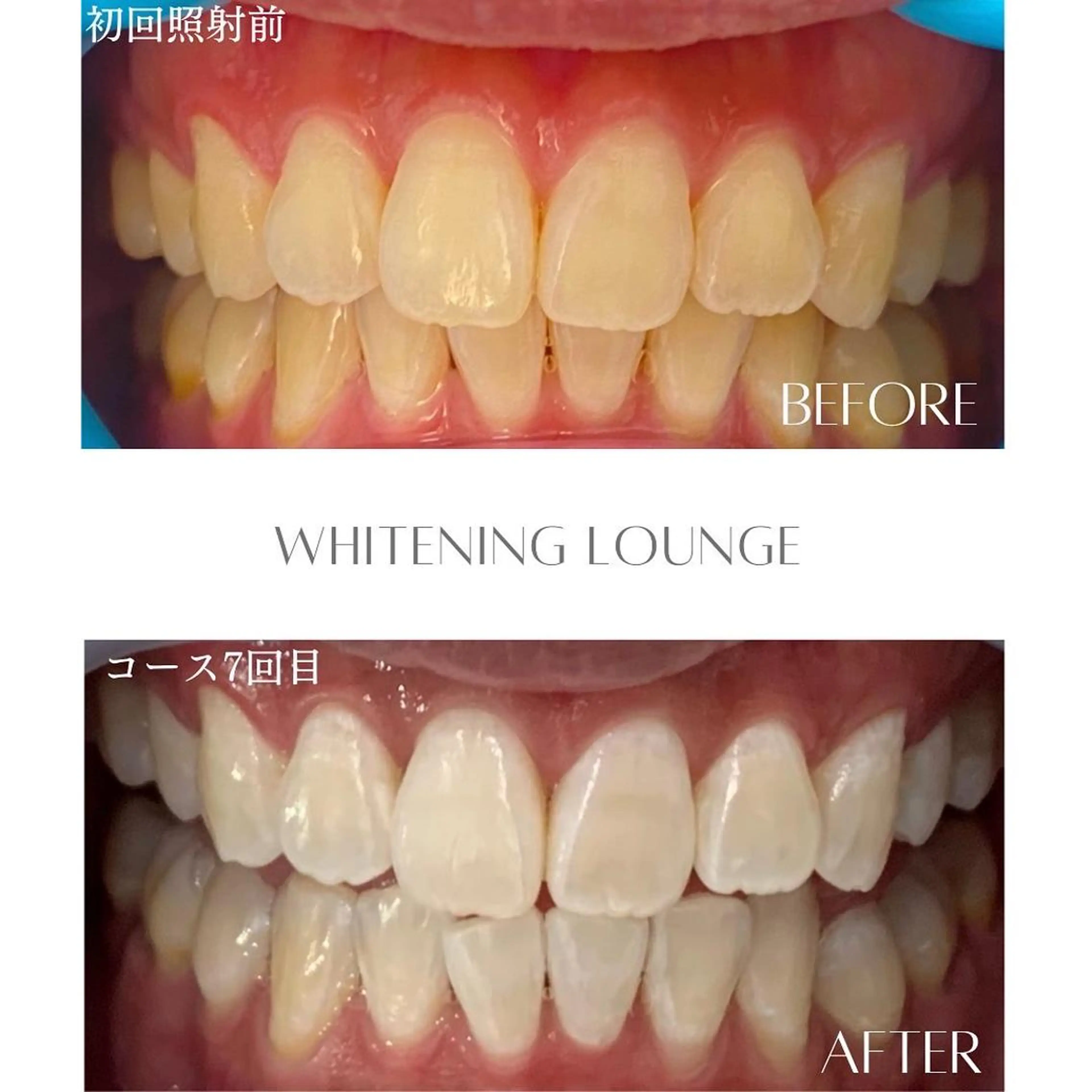 その他 ホワイトニングラウンジ横須賀所属・ホワイトニング Lounge横須賀のその他イメージ