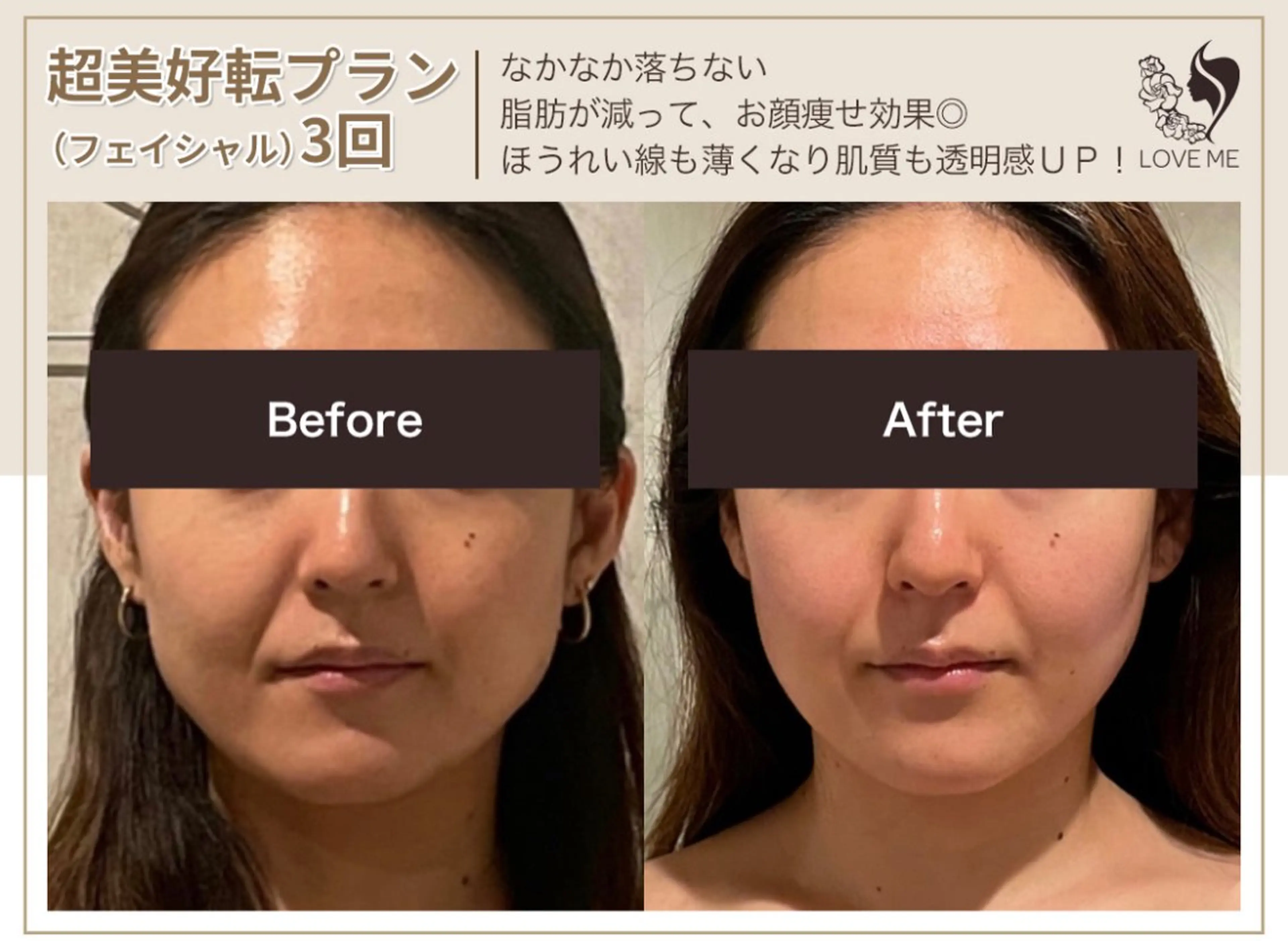 総合美容サロン LOVEME渋谷本店のエステ・リラクイメージ