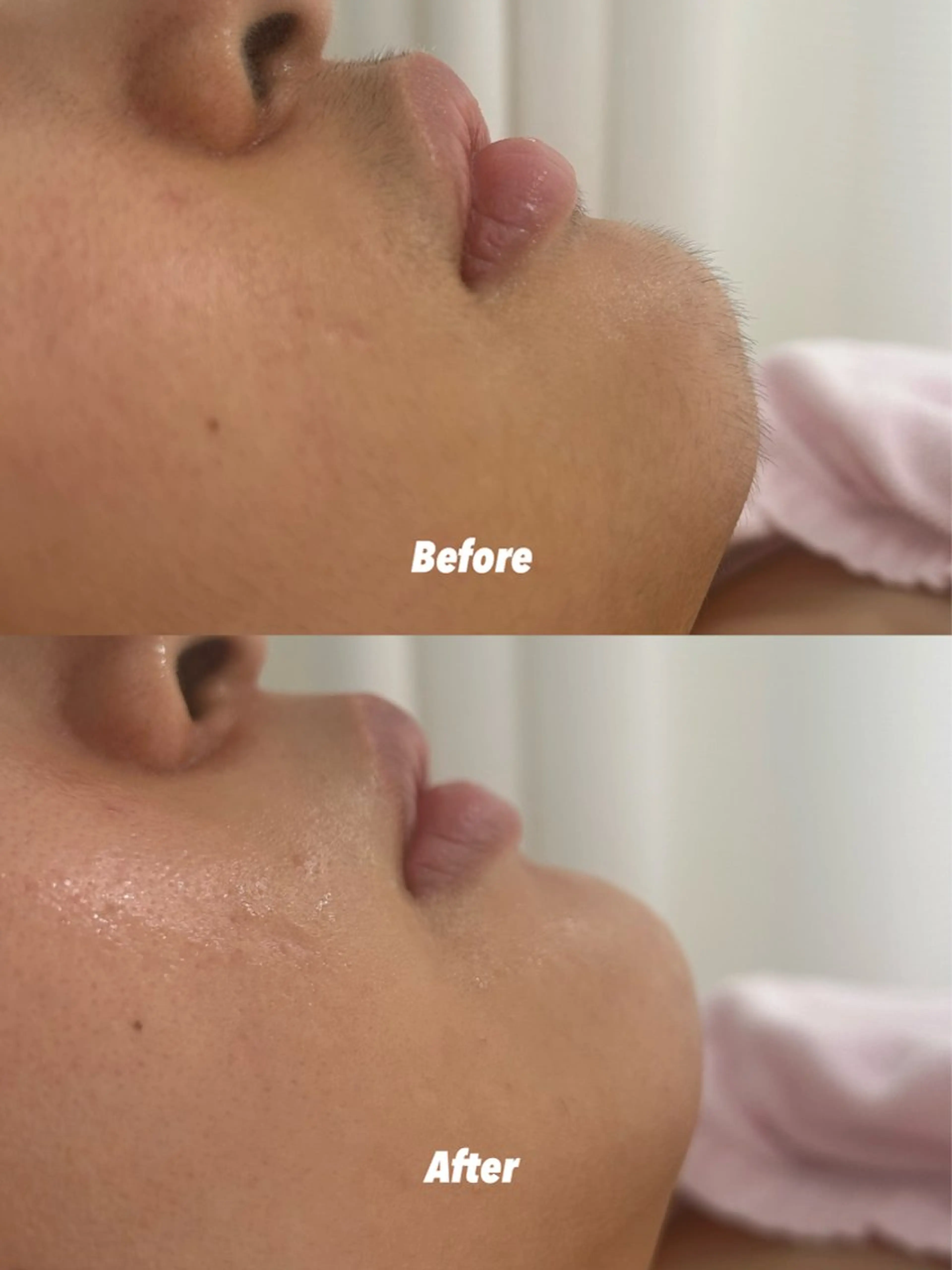 エステ リラク 🫧美しい素肌へ🫧 今成柚乃のその他イメージ