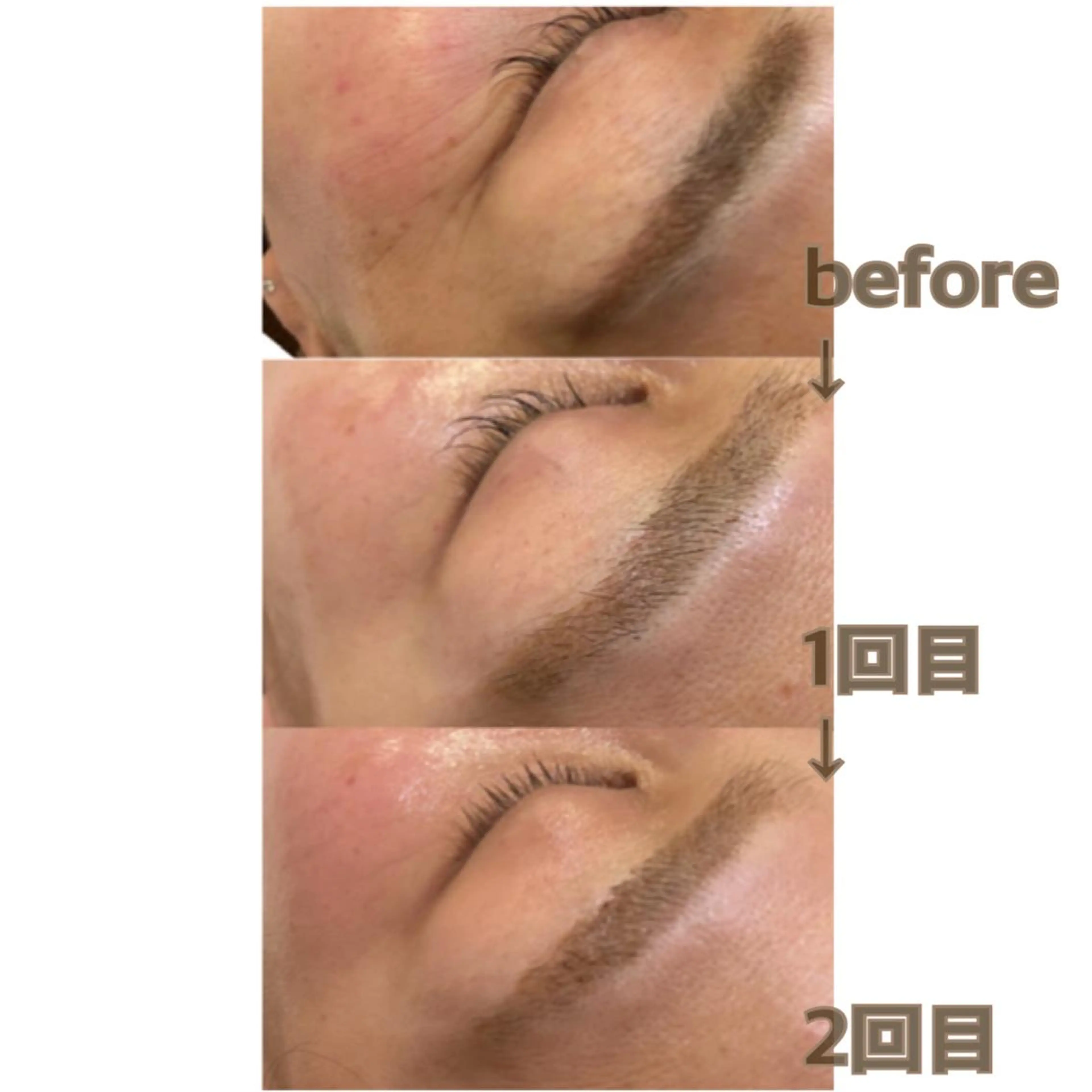 aroma  YURARI所属・韓国艶美人// 毛穴ケア🌹のエステ・リラクイメージ