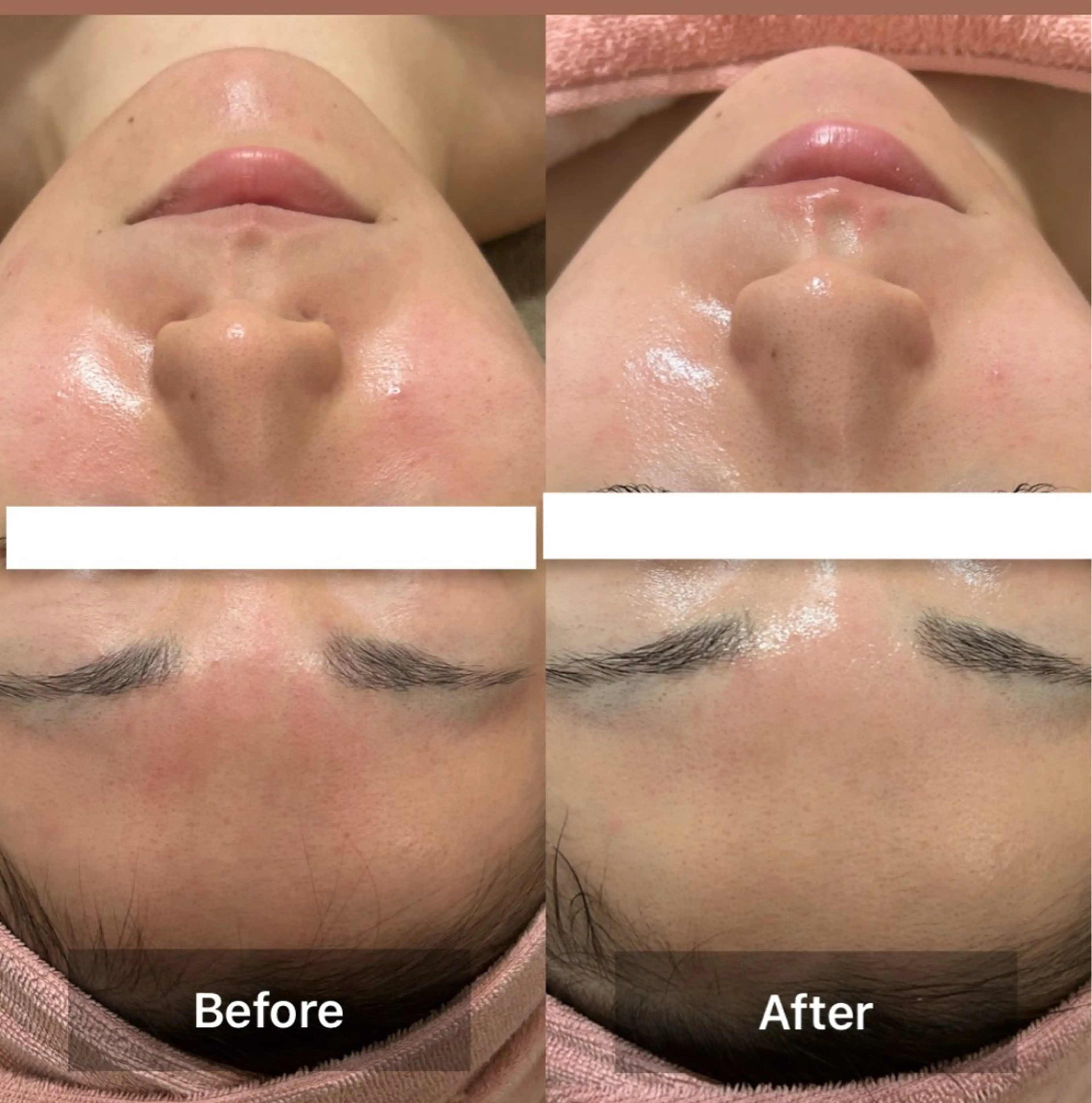 Eclavie所属・エクラヴィ 小顔・エイジングケアのエステ・リラクイメージ