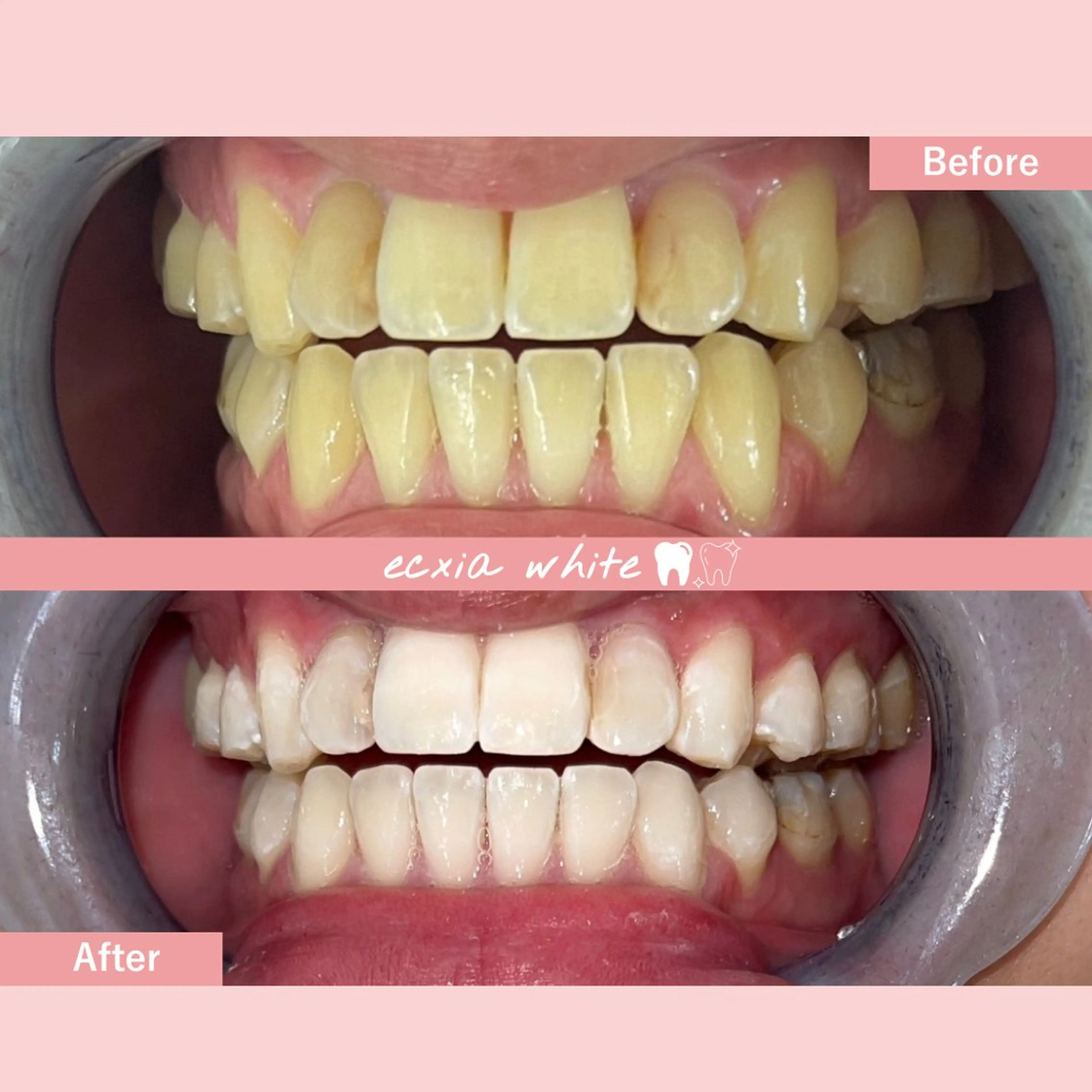 セルフホワイトニング エクシア札幌琴似店のその他イメージ