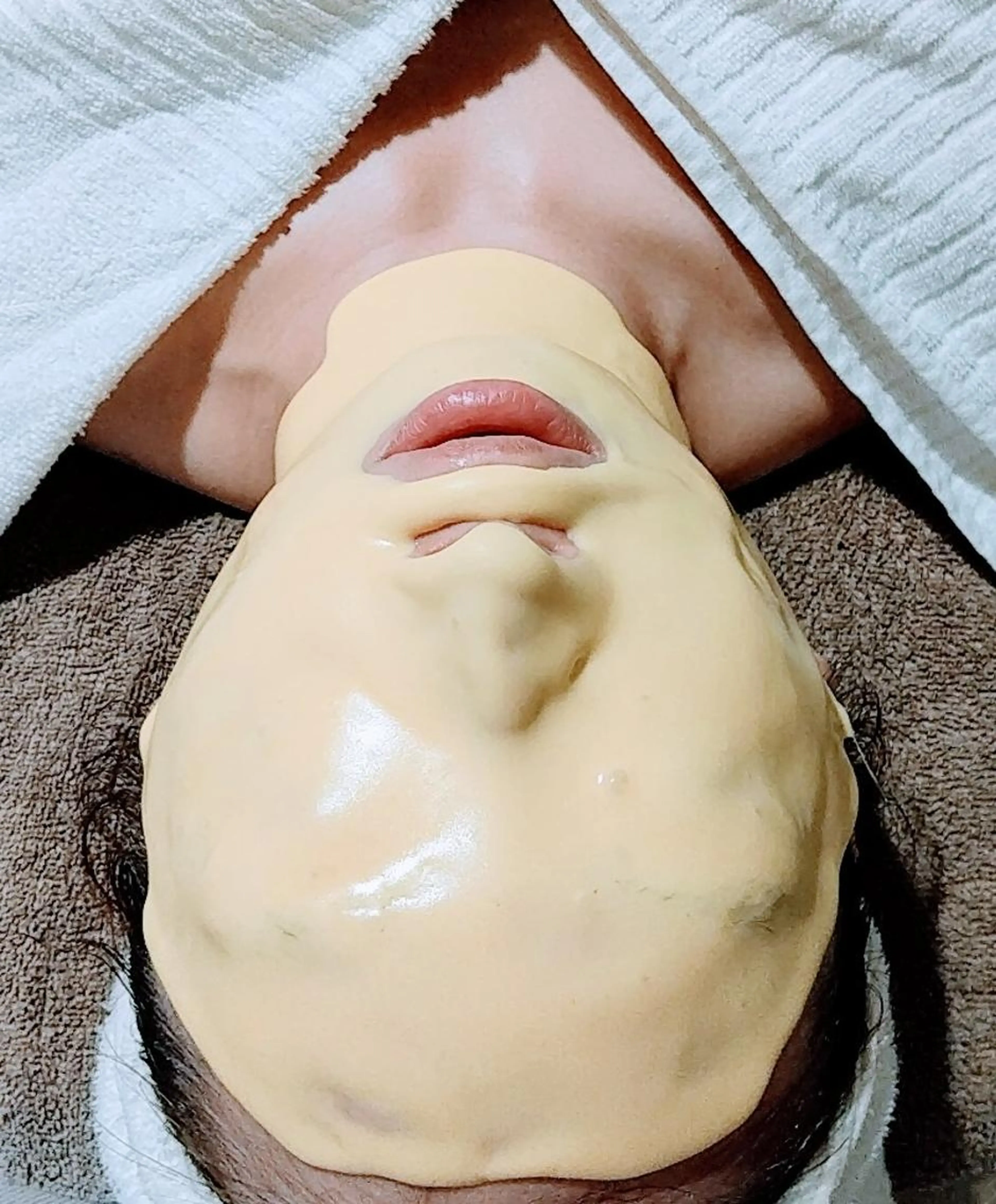 くすみが気になる方におすすめ💕お土産&無料AI肌チェック付き🎁ビタミン補給のパック+イルネージュアドバンスコースの写真