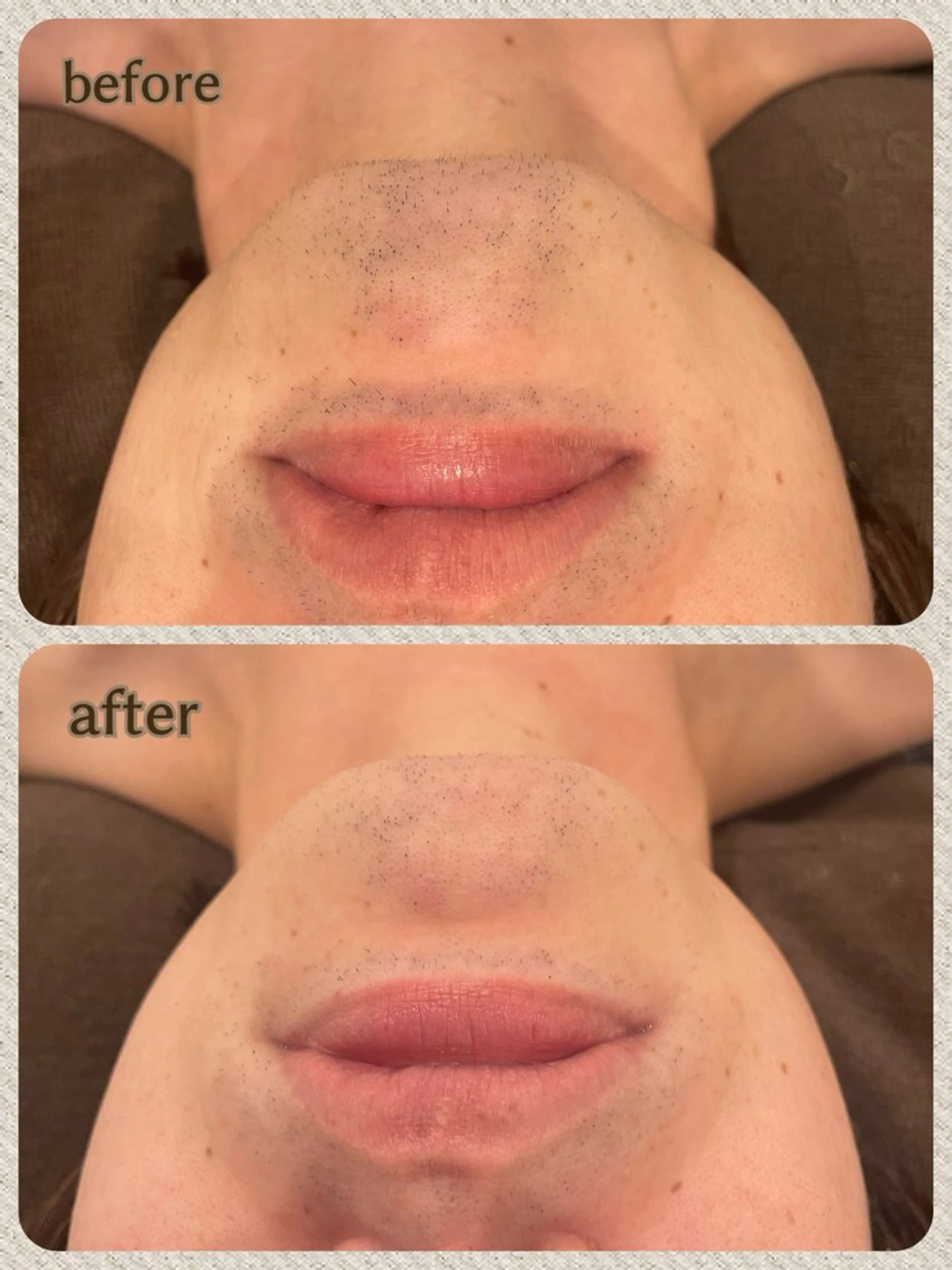 脱毛 LeCoeur喜多町 松本のエステ・リラクイメージ