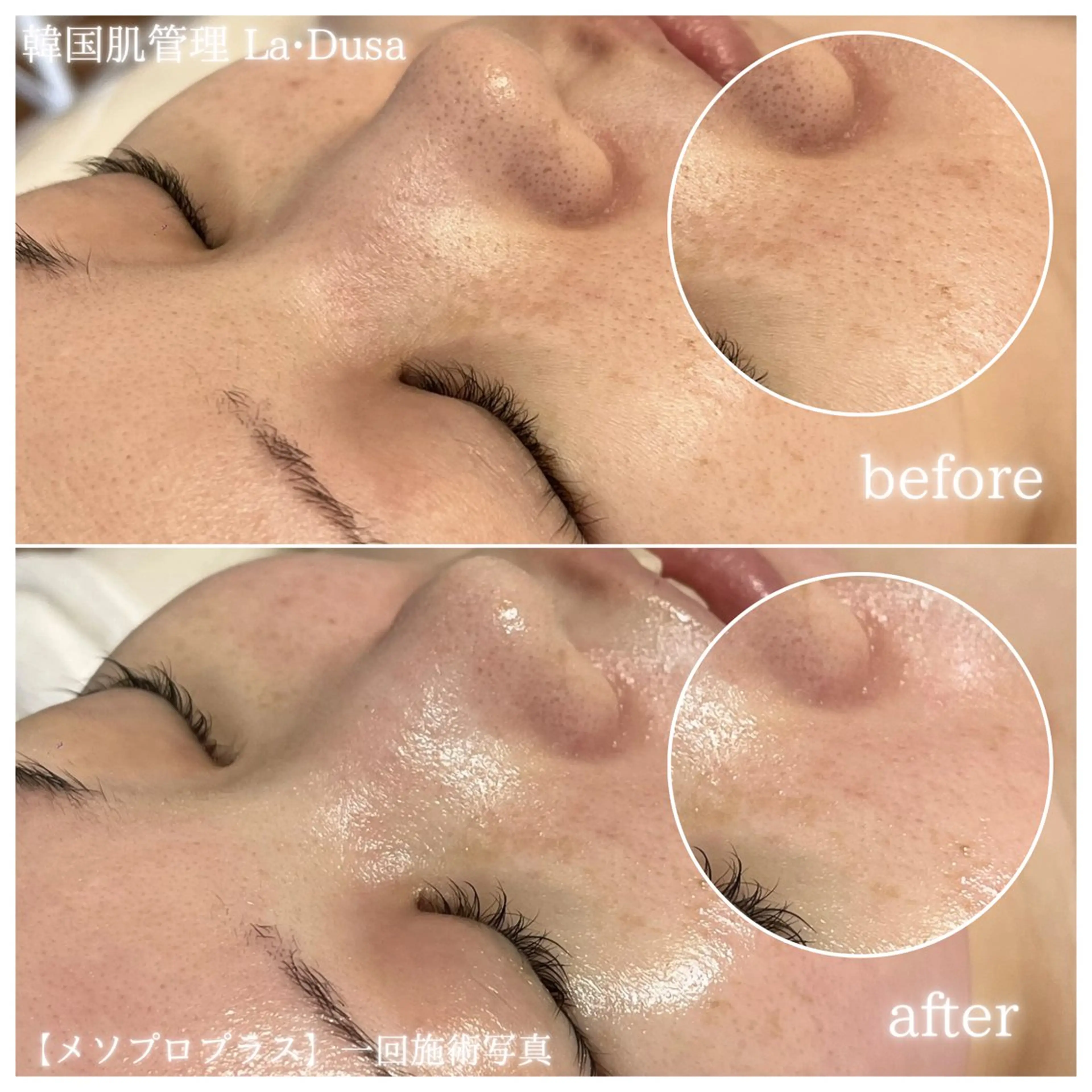 エステ リラク La Dusa 韓国肌管理/小波のエステ・リラクイメージ