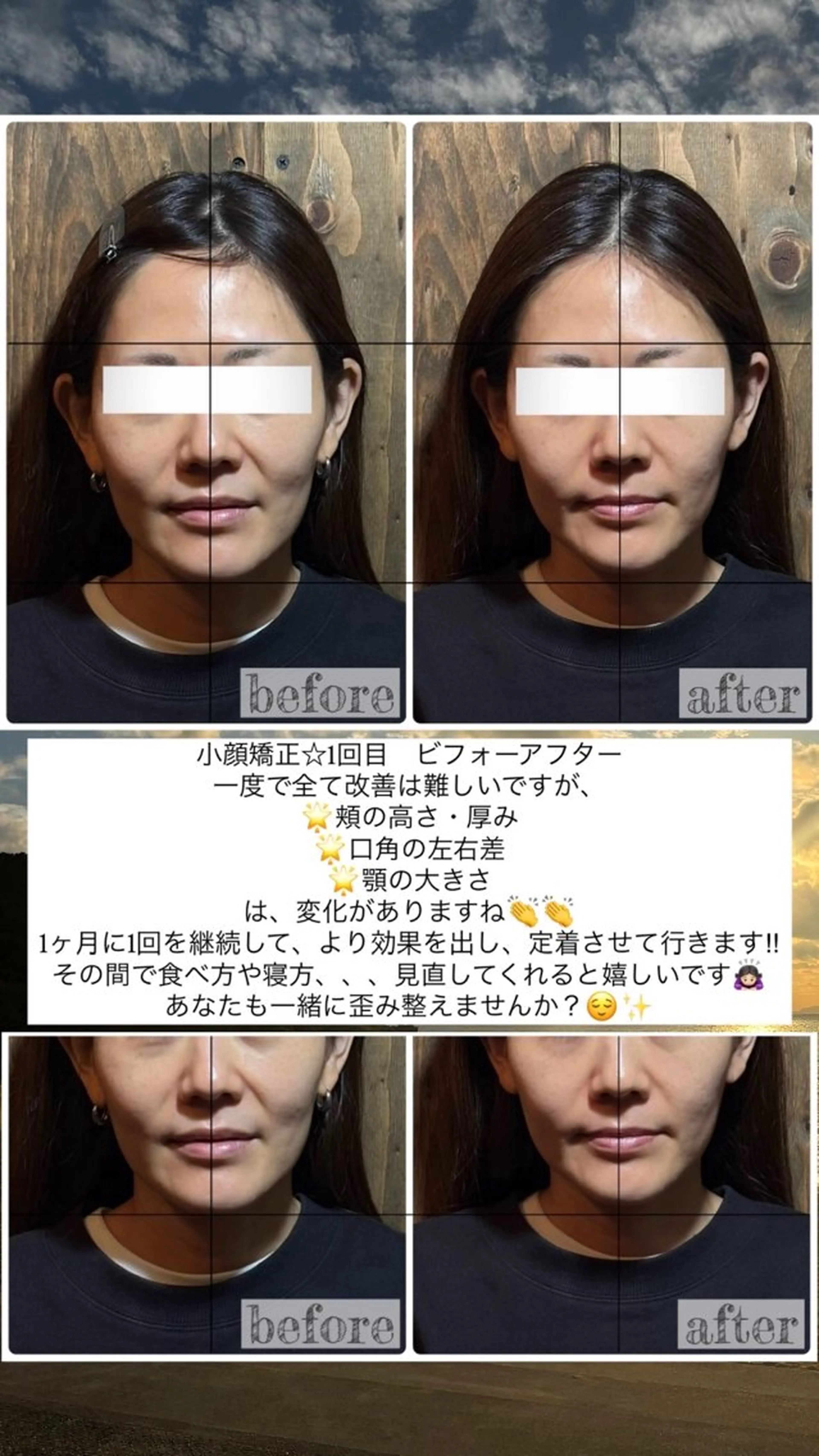 エステ リラク 💎後悔させない小顔 矯正💎イトヤマ🌱のエステ・リラクイメージ