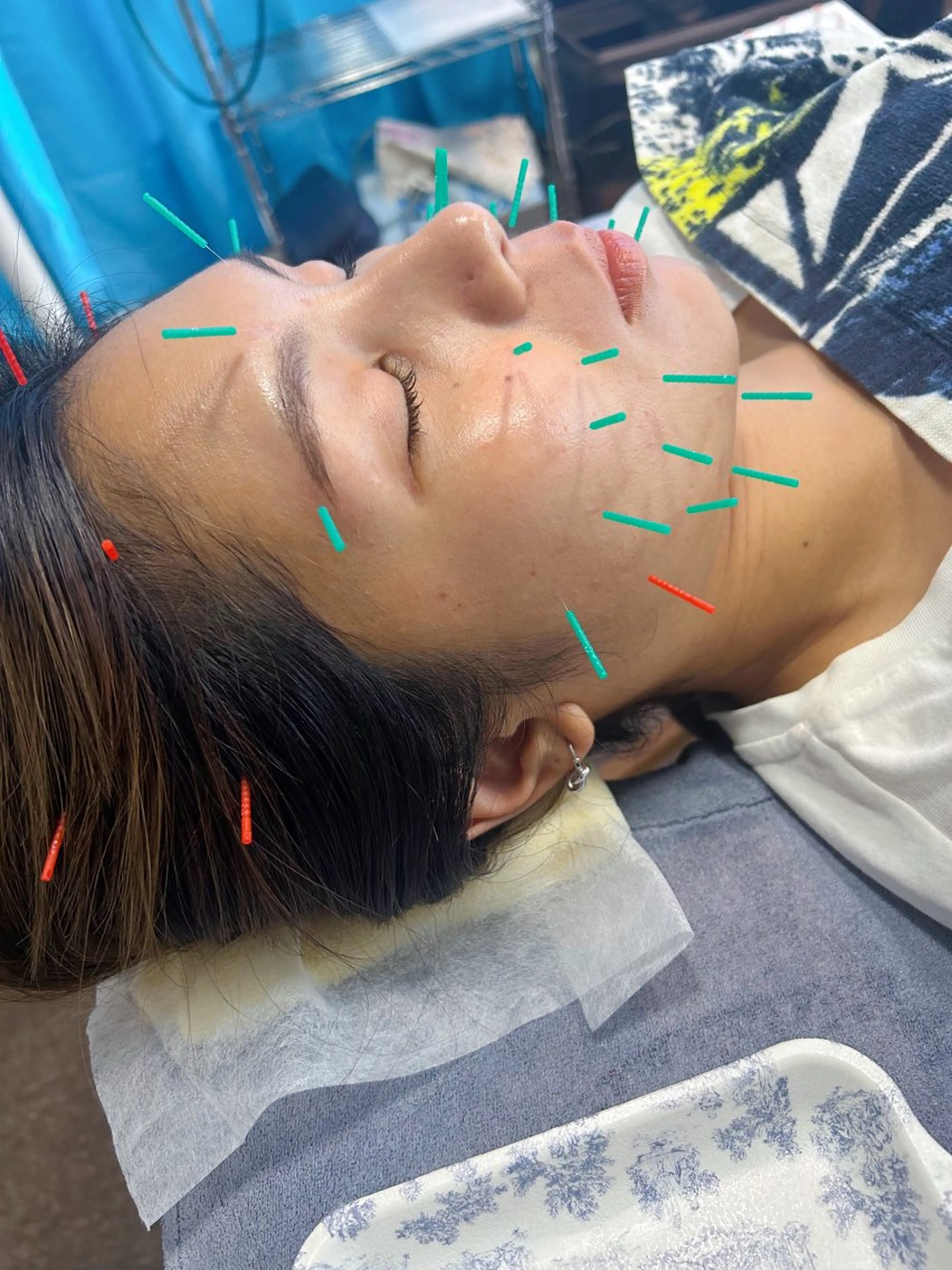 エステ リラク 代々木美容鍼灸サロン"さくら"所属・🌸代々木美容鍼灸 サロン"さくら"🌸のエステ・リラクイメージ