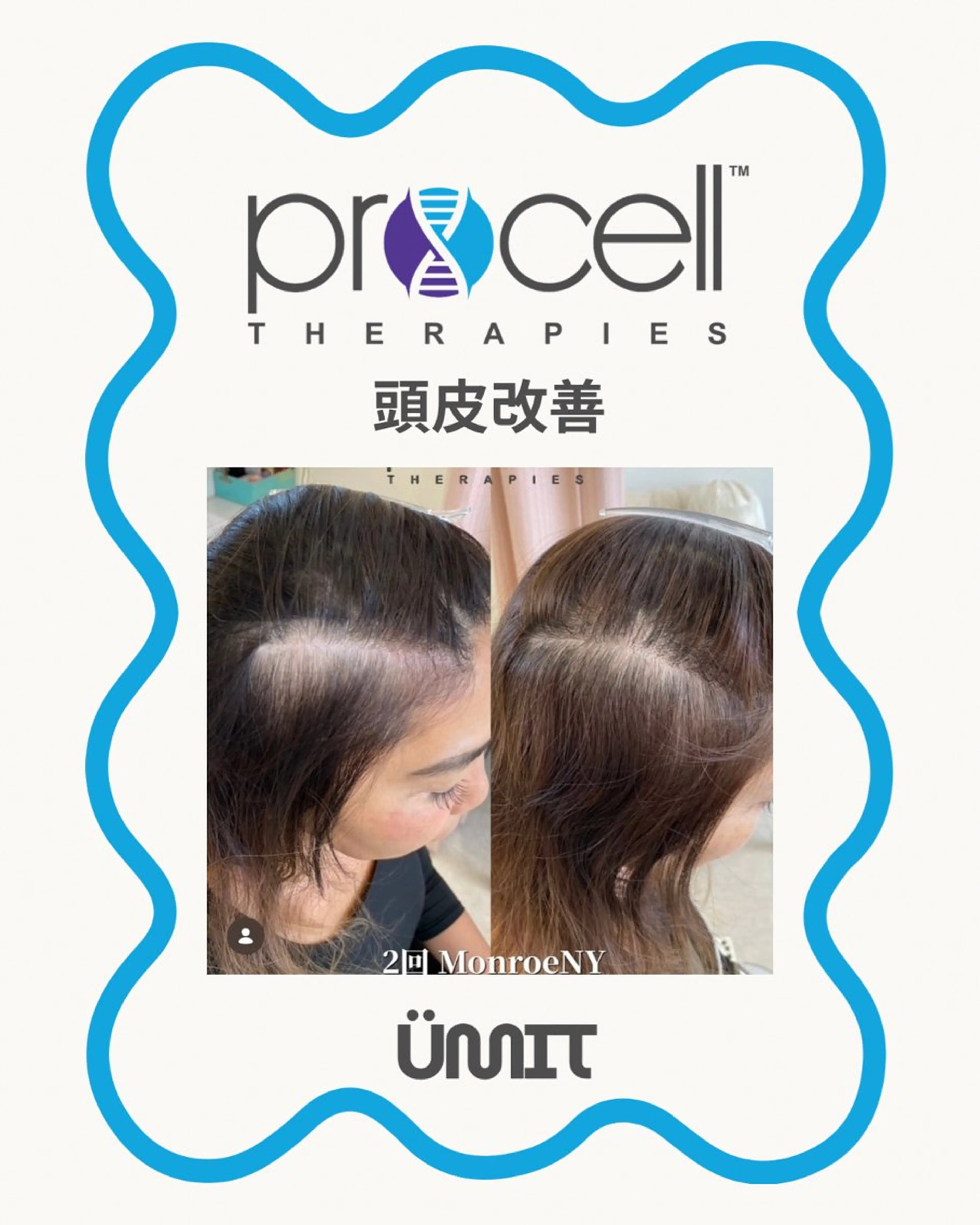 ヘッドスパ Ümit（ユミト） プロセルセラピーズのネイルデザイン