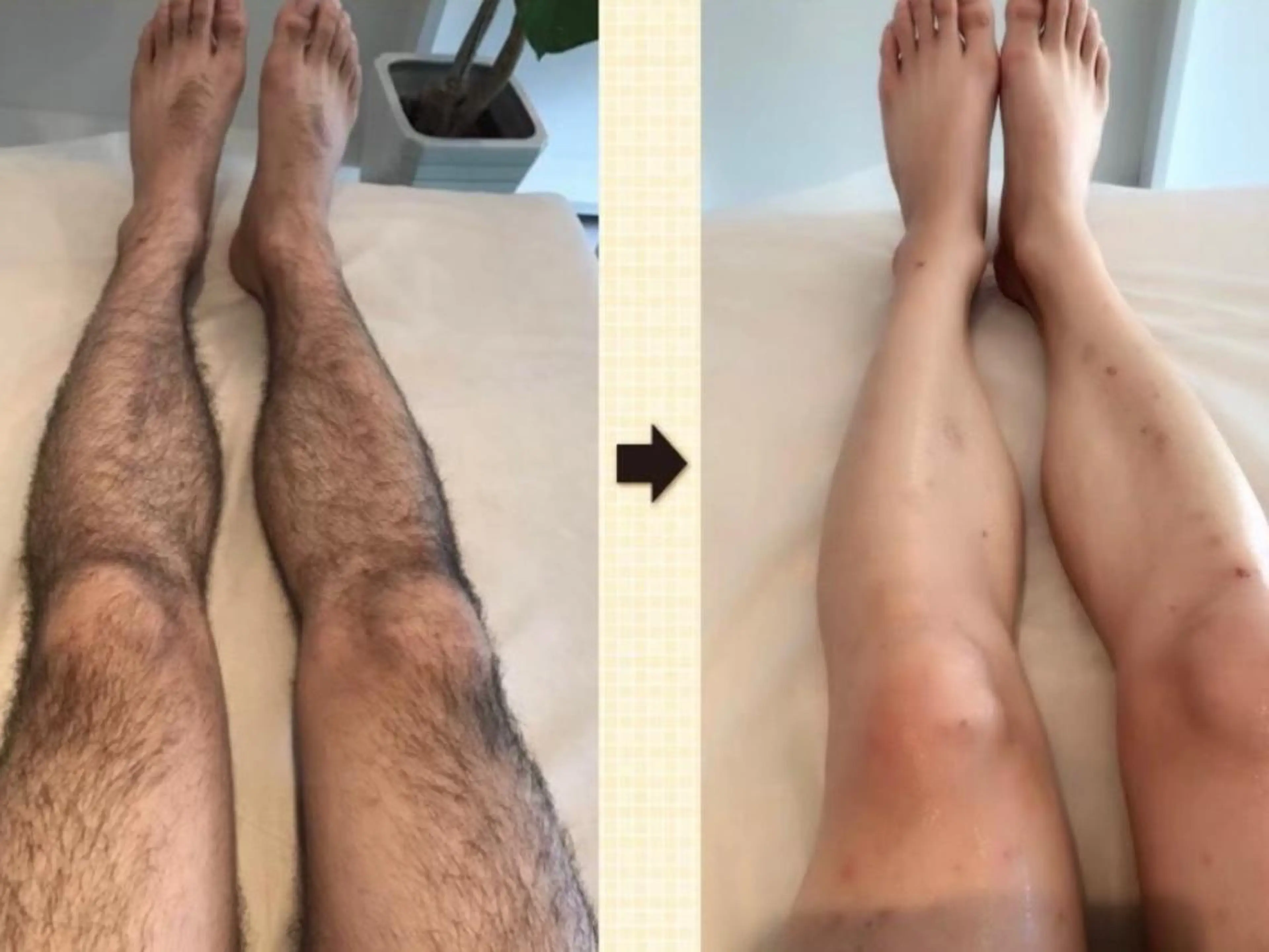 CHICIEL所属・枚方市香里園脱毛 サロンCHICIELのエステ・リラクイメージ