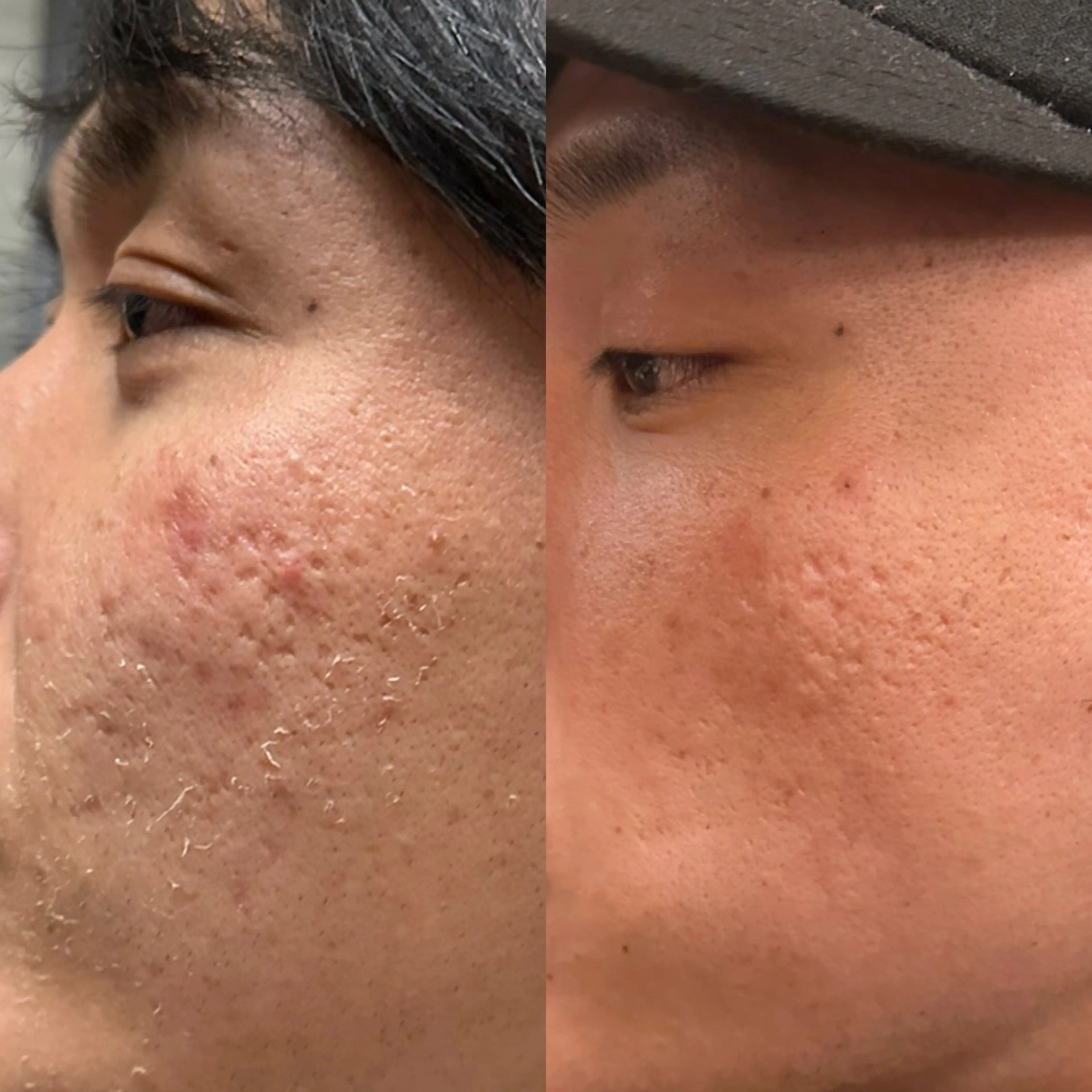 エステサロンTug高知駅前店所属・Tug 高知駅前店/ NANAMI🌐のエステ・リラクイメージ