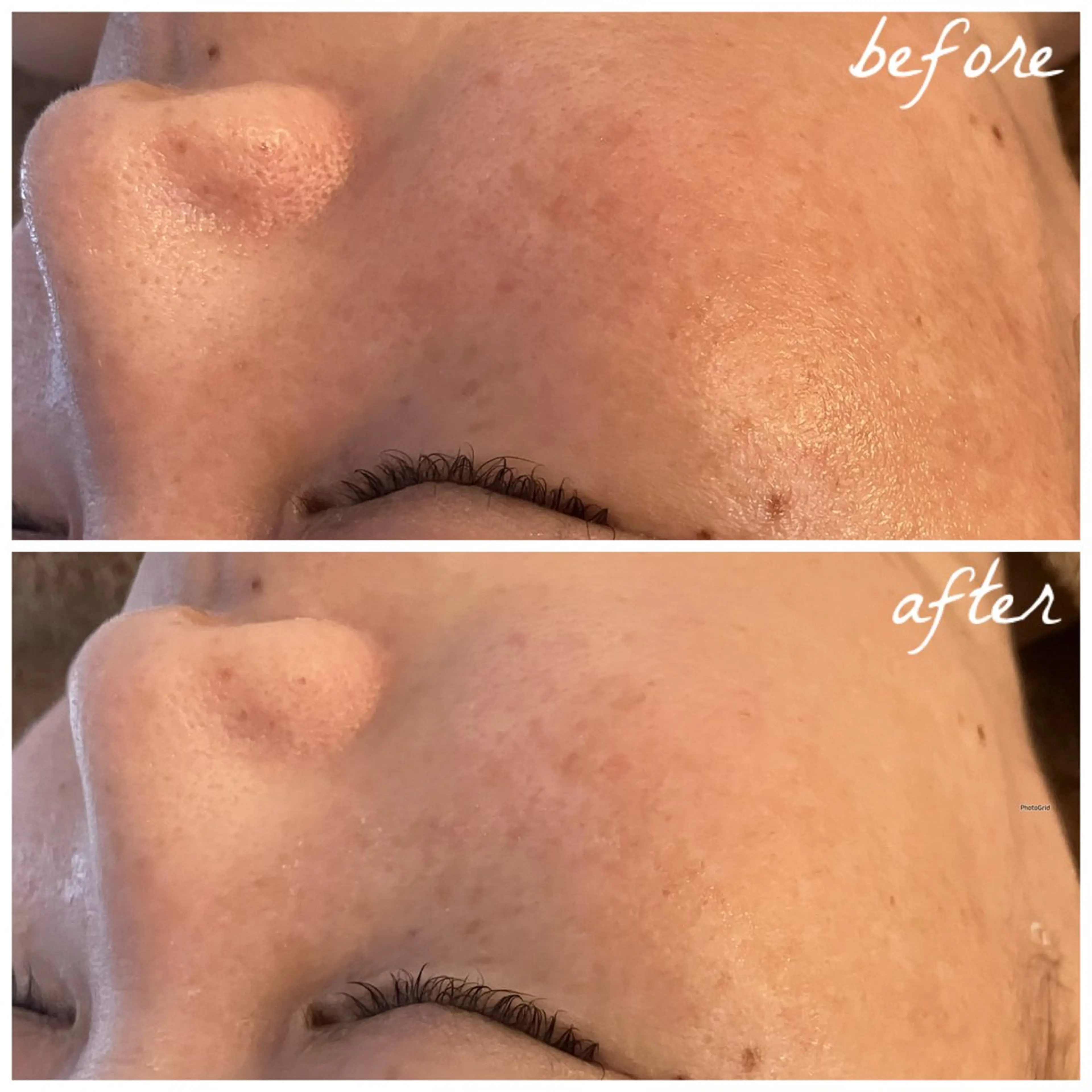 メンズ エステ メナード岐阜茜部 杉浦のエステ・リラクイメージ