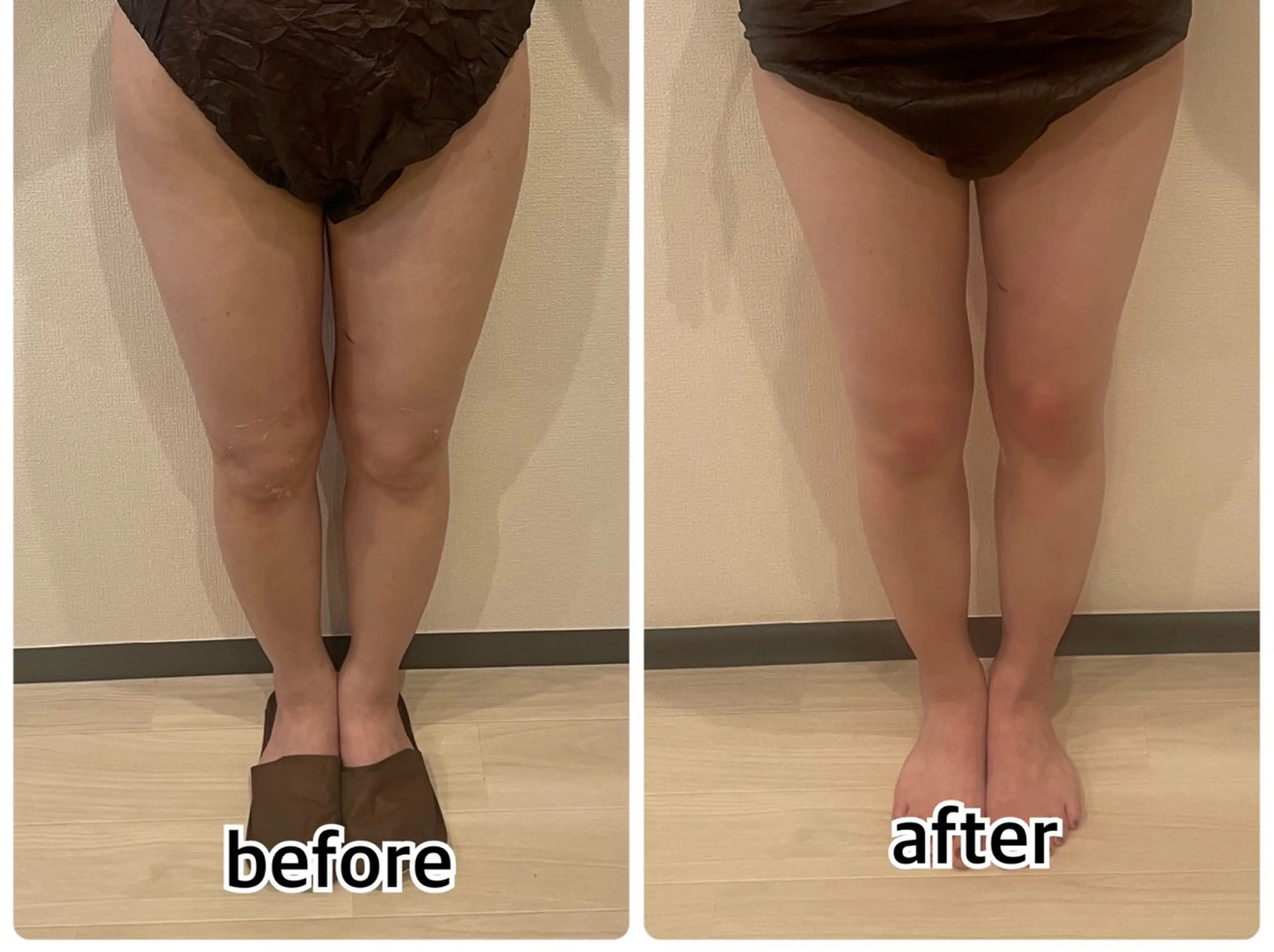 💎インディバ GEM💎indiba   healing room GEM所属・💎 GEM💎のエステ・リラクイメージ