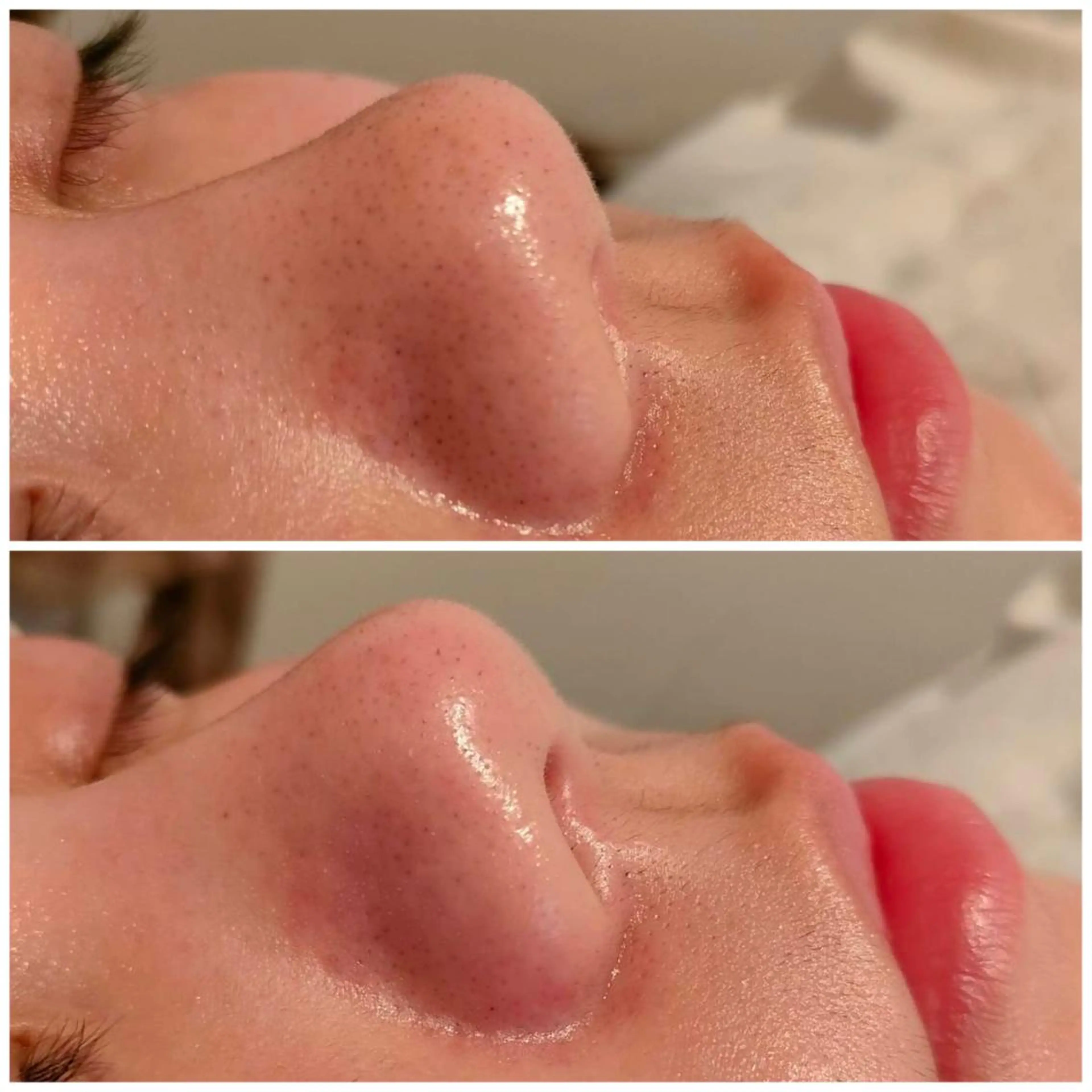 アイブロウ ワックス脱毛 眉カット その他(アイブロウ) Ｂ&H所属・頭痛•肩こり専門/ 眉サロンB&H心斎橋のエステ・リラクイメージ