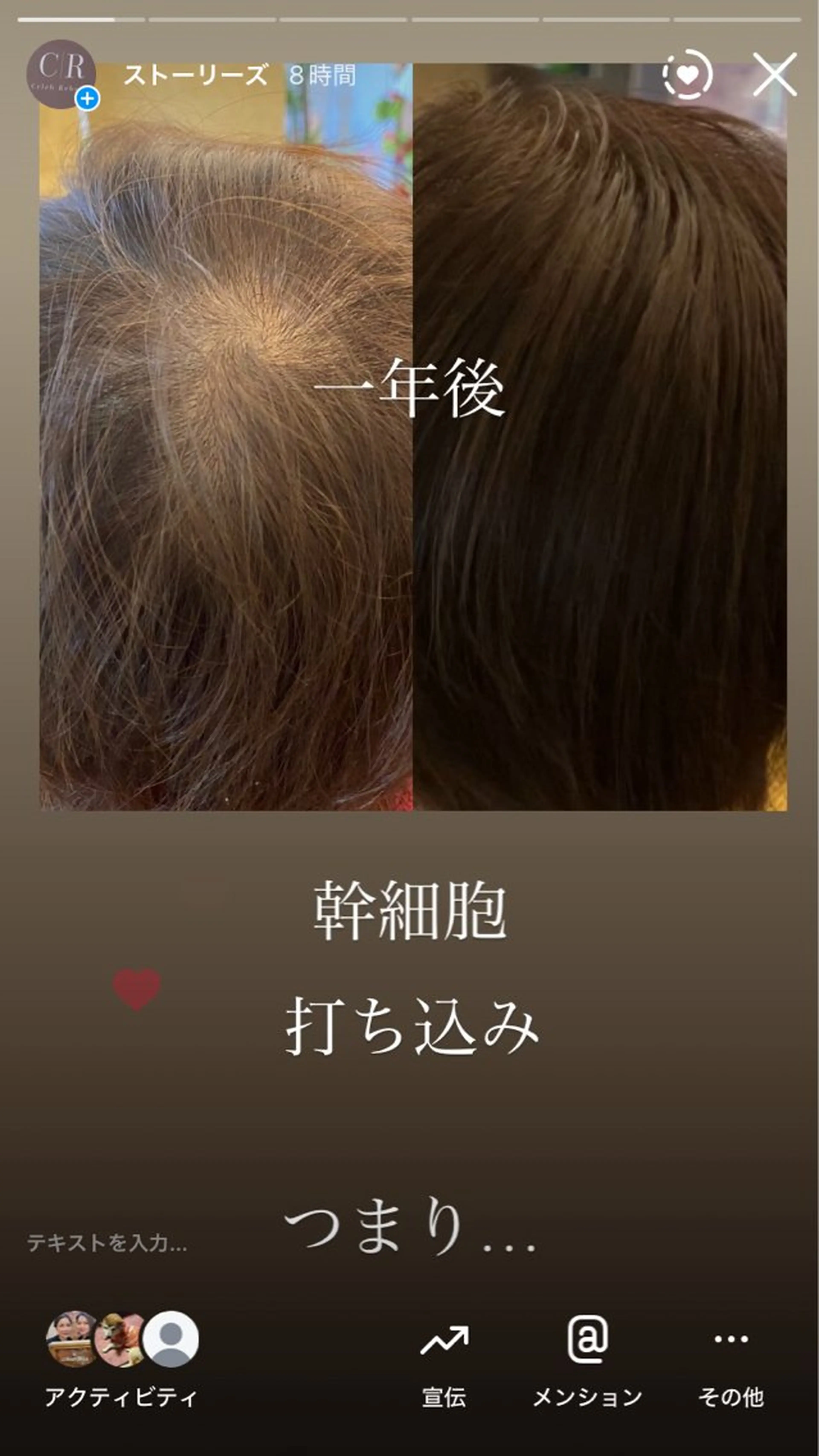 撮影モデル セレブリボーンパッシブタウン　プレミア所属・目澤 幸代のエステ・リラクイメージ