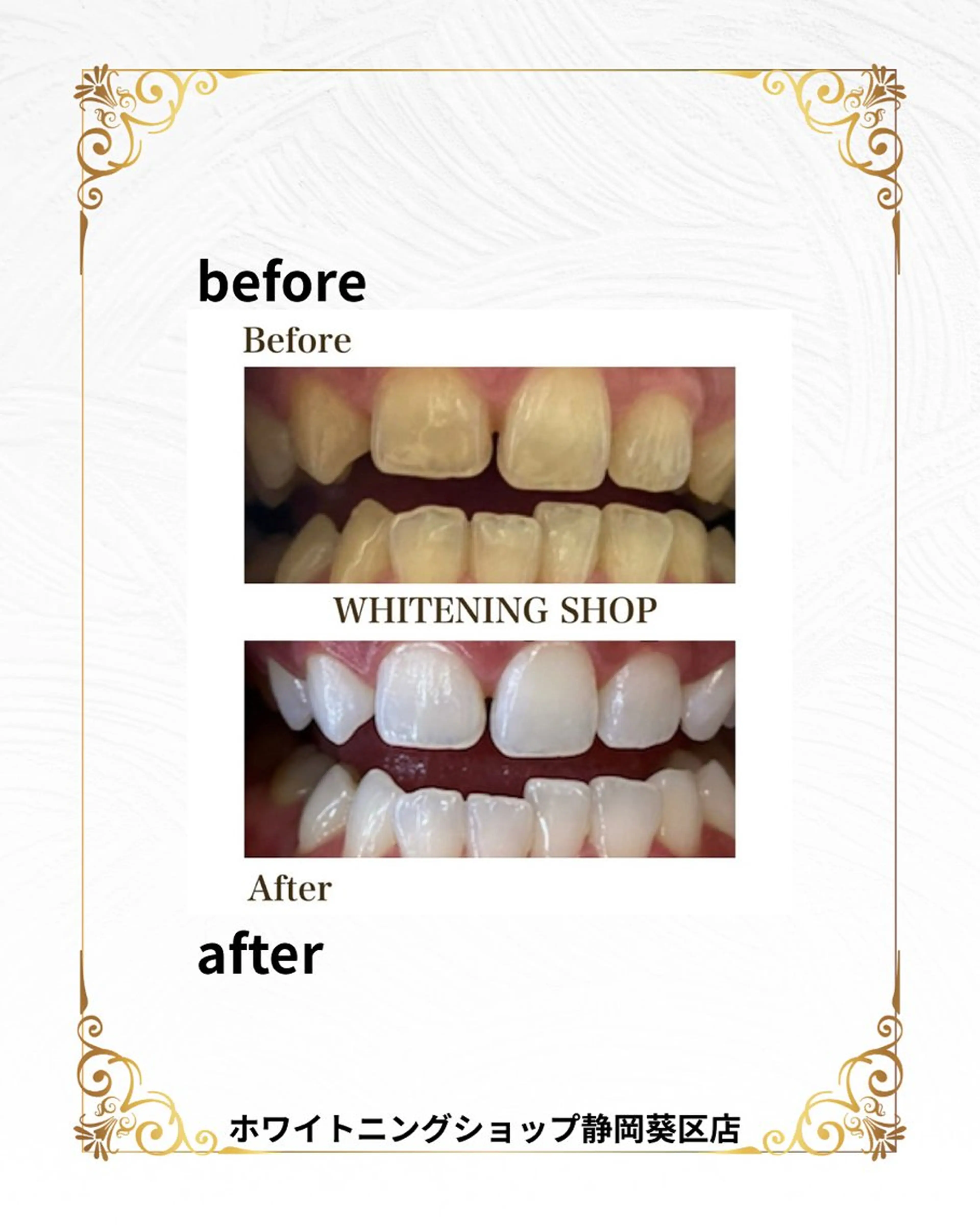 その他 ホワイトニングショップ静岡葵区店所属・ホワイトニング ショップ静岡葵区店のその他イメージ