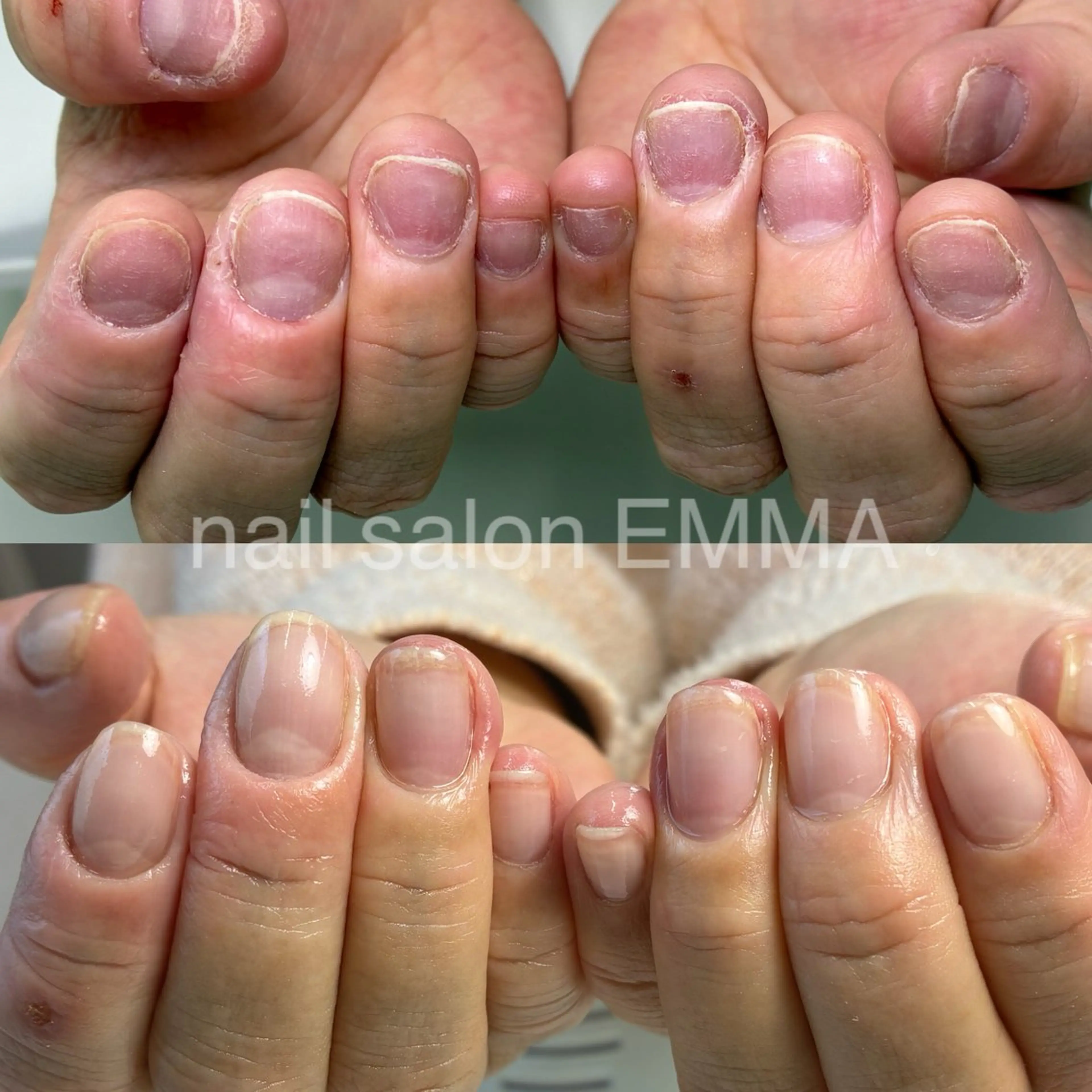 ネイル 広島市南区(広島県) /深爪/自爪育成のネイルデザイン