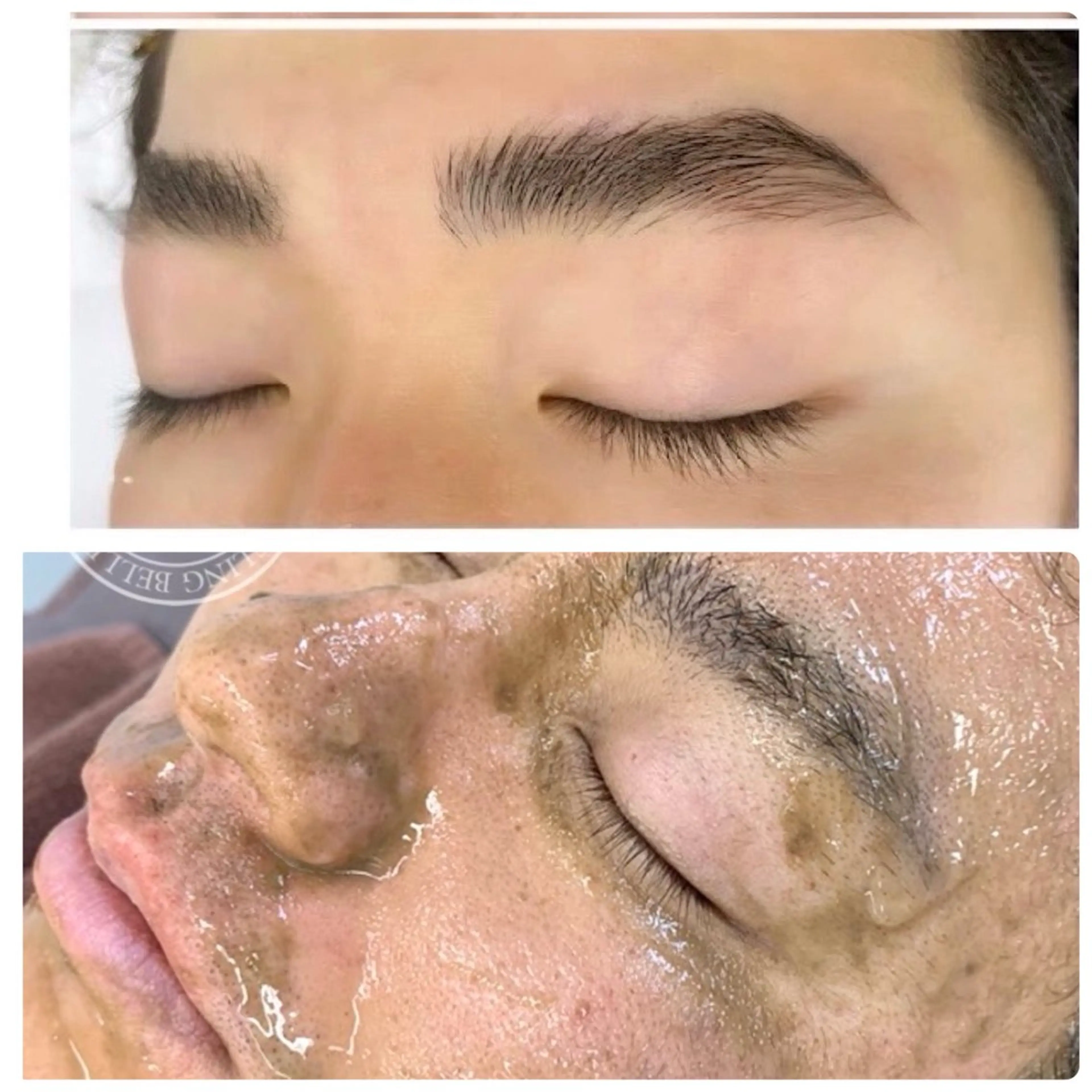 【メンズ】眉毛WAX脱毛+肌質改善ピーリング《美眉&美肌》の写真