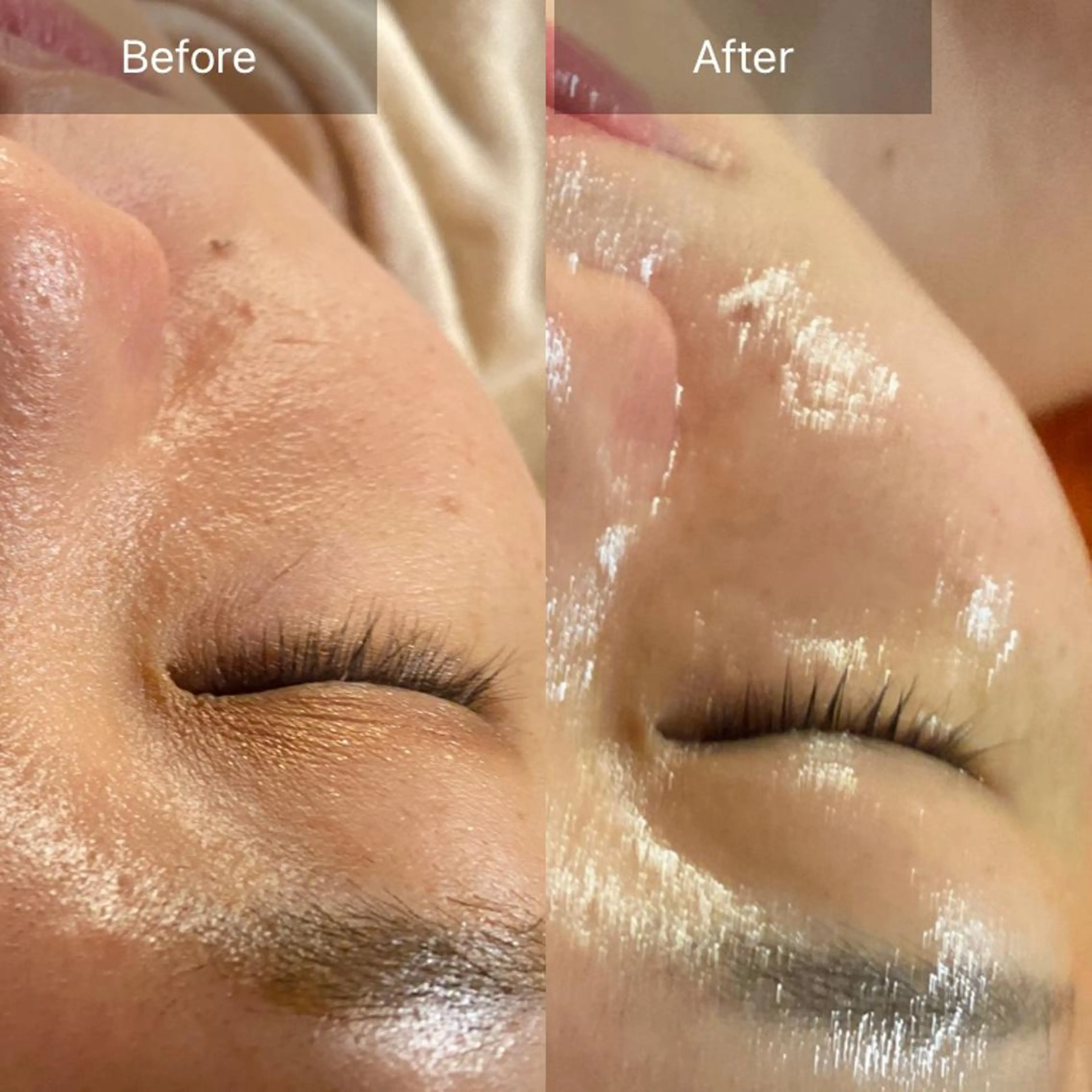 Mandarin Orange所属・毛穴から始める肌メン テマンダリンオレンジのエステ・リラクイメージ