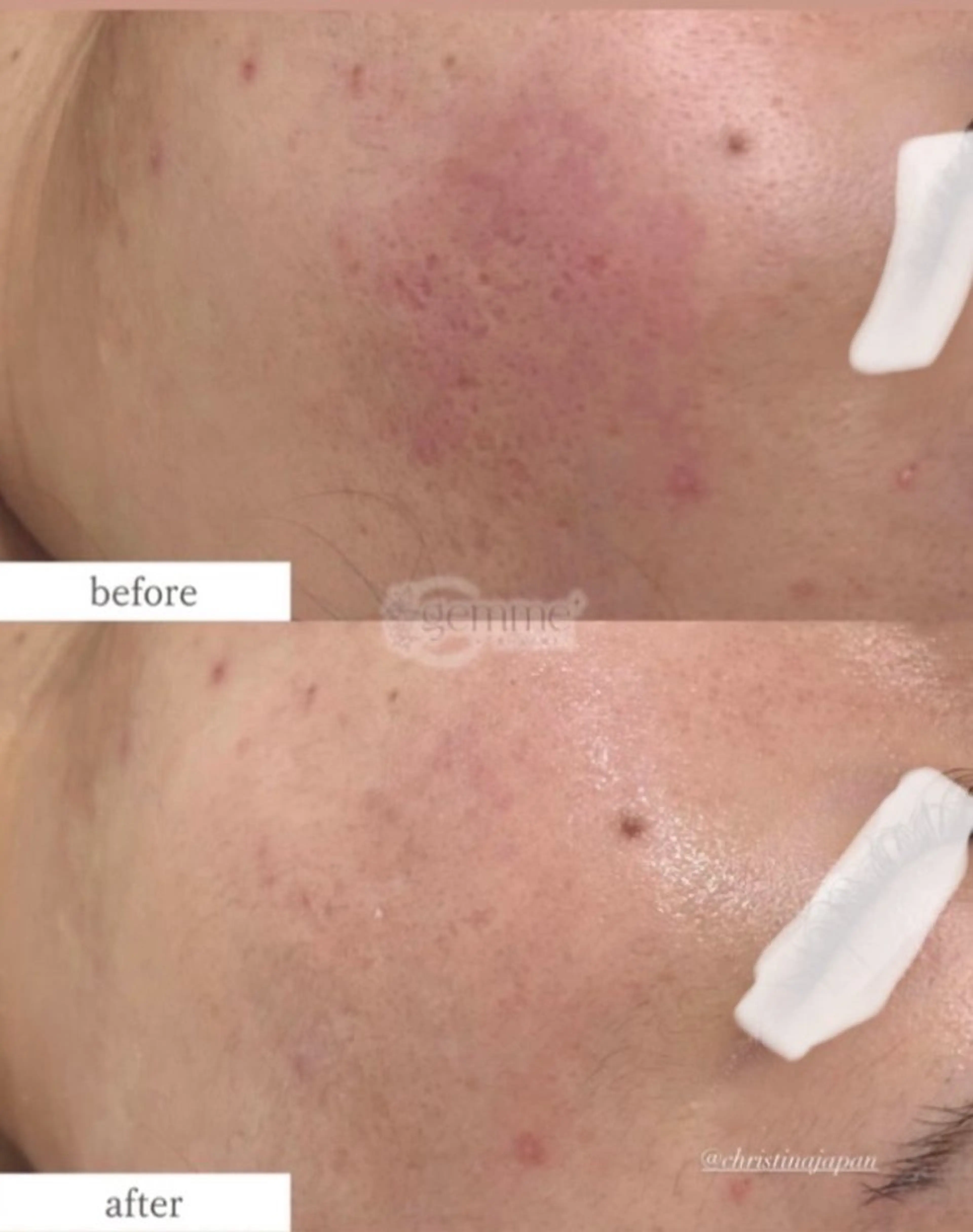 井上 裕子のエステ・リラクイメージ