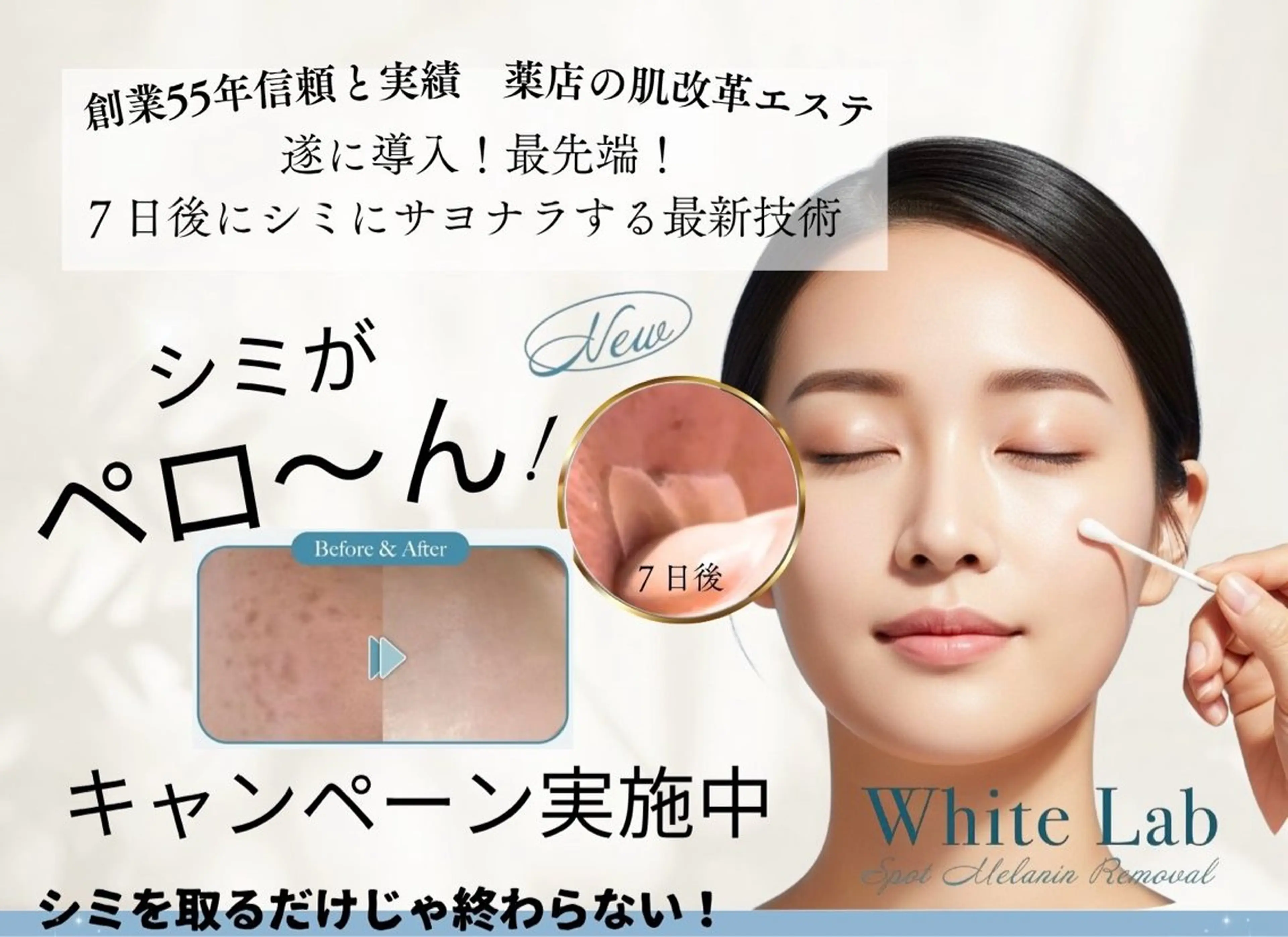 [シミ回収します！]レーザーでは難しかったシミ・肝班にも対応。8日後にはベロ​〜​んと変化を実感！の写真