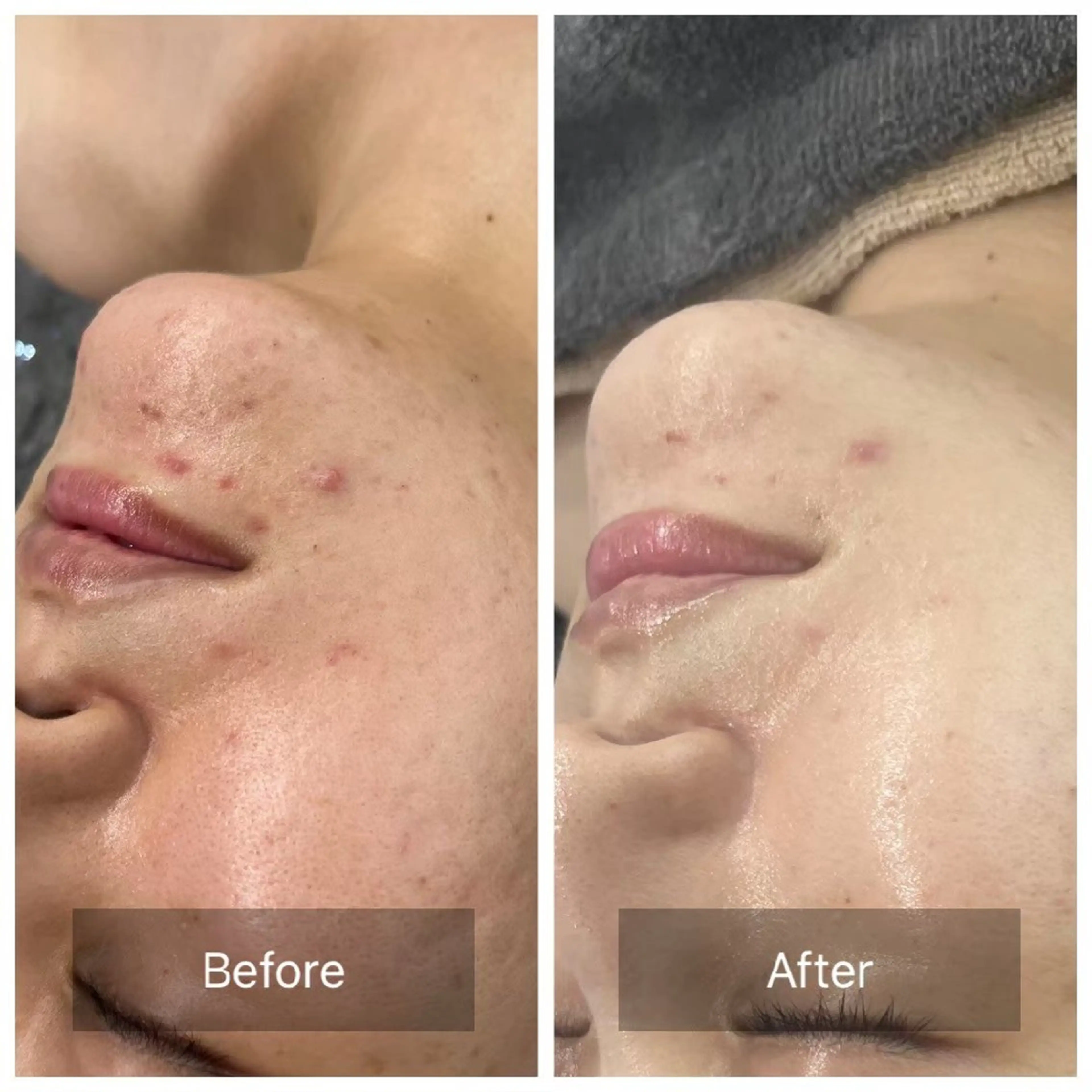 エステ Iryアイリー所属・Iry アイリーのエステ・リラクイメージ