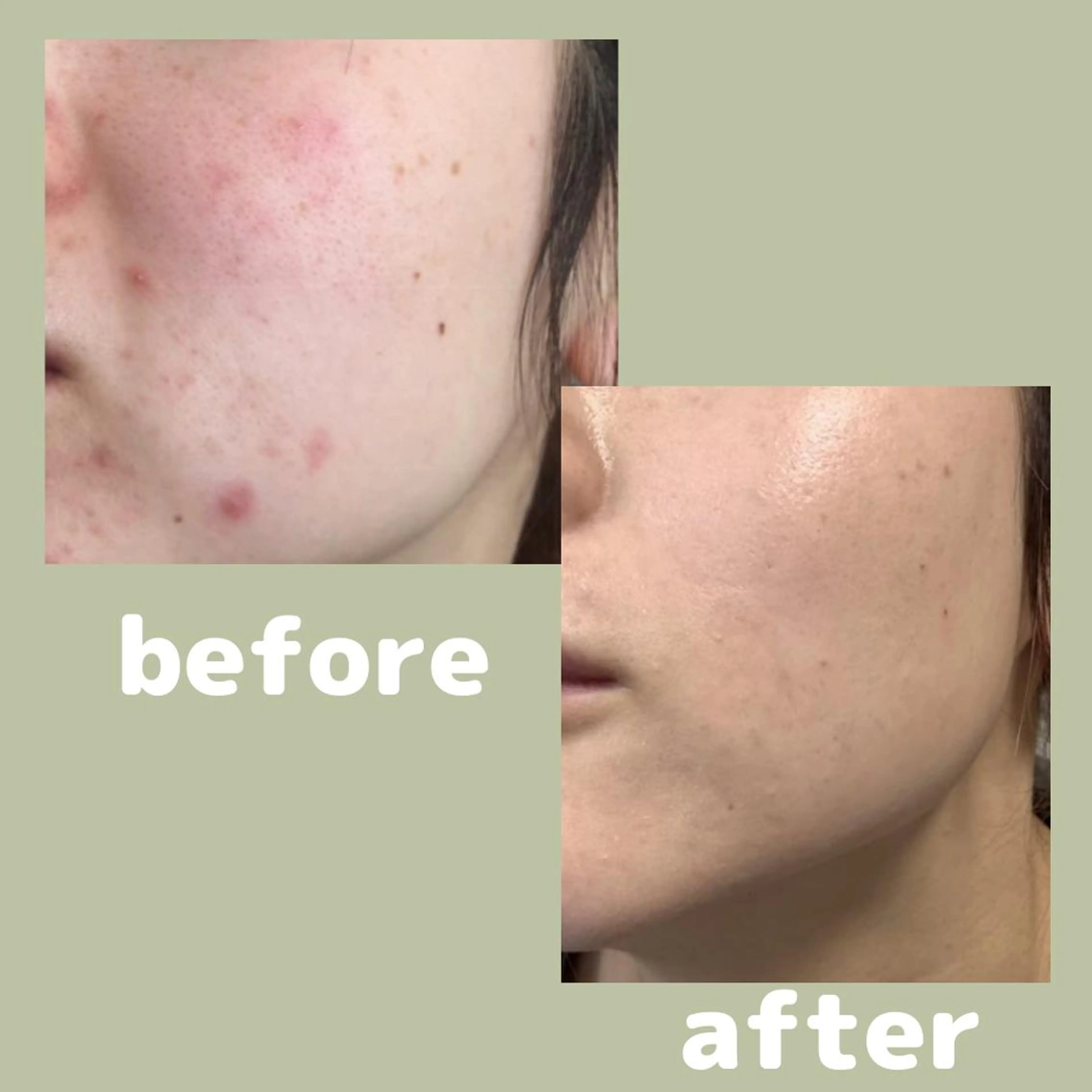 美容鍼灸サロン      APLUS所属・美容鍼灸サロン APLUSのエステ・リラクイメージ