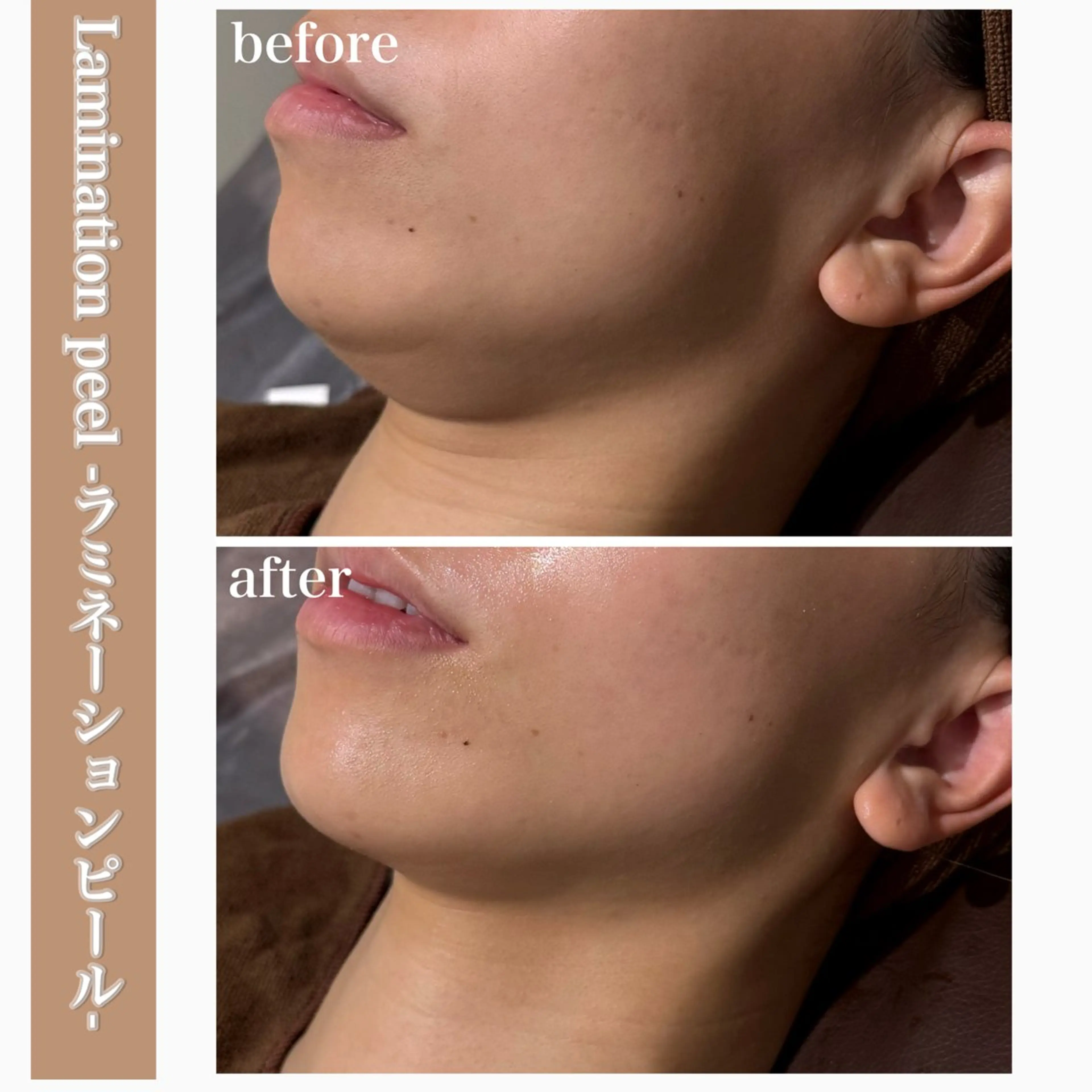 エステ beautysalon RAVIS所属・東大阪/韓国肌管理/ 痩身バスト専門店のエステ・リラクイメージ