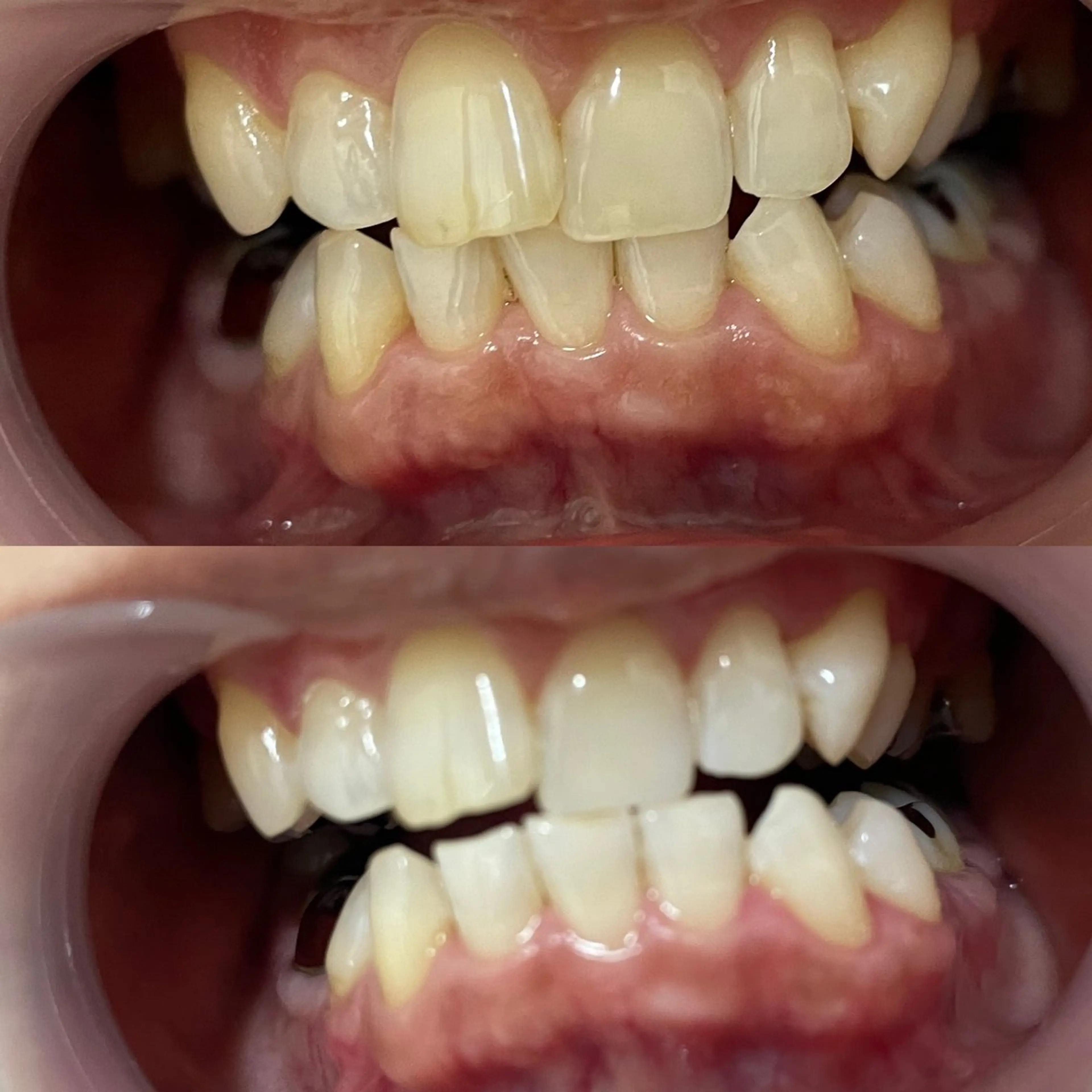 西宮ホワイトニング Kirarie所属・志水 有美のエステ・リラクイメージ