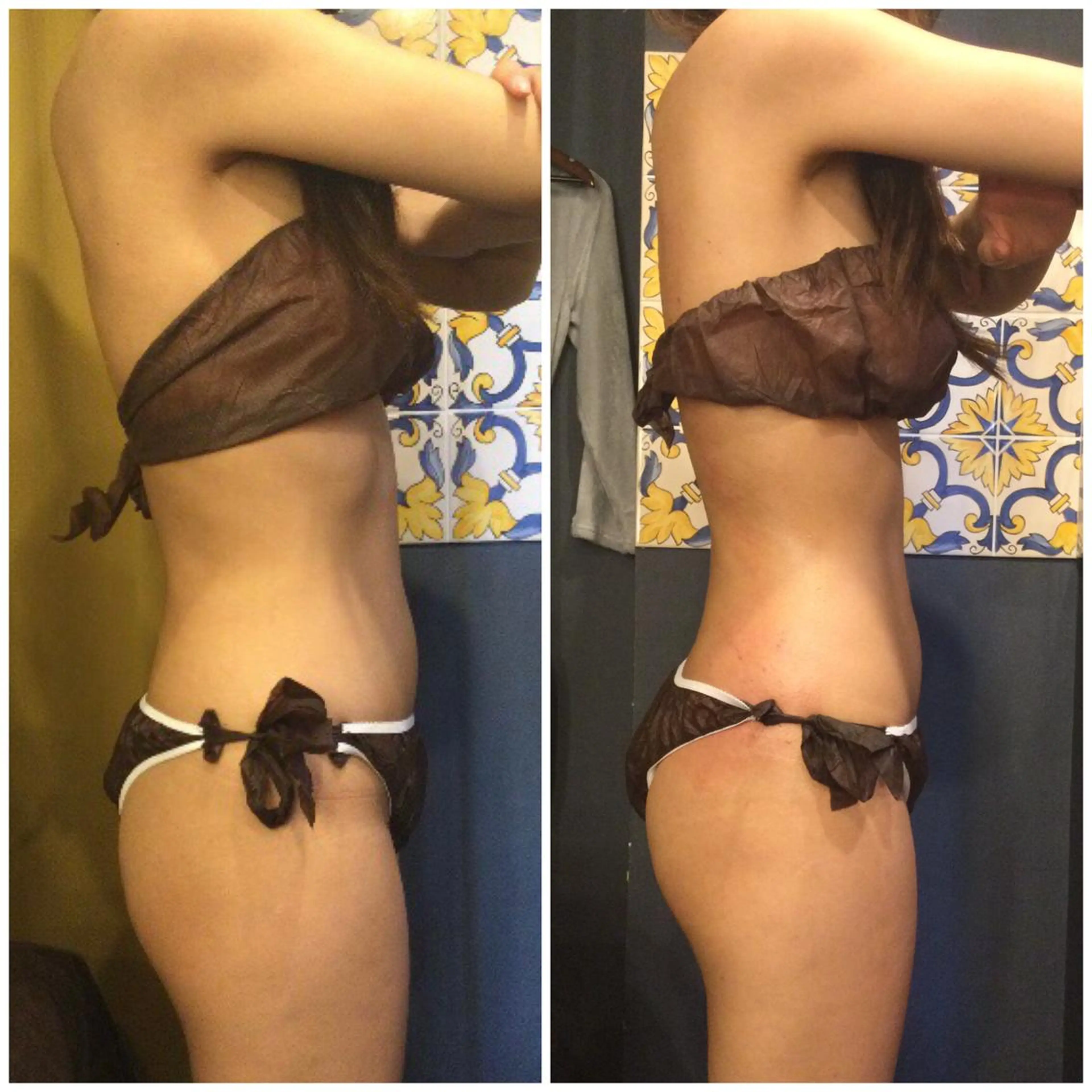 【口コミOKの方‼️写真掲載OKな方‼️限定】破格👑 サーモシェイプDeep＋スリムムーブ＋痩身クリーム💓の写真