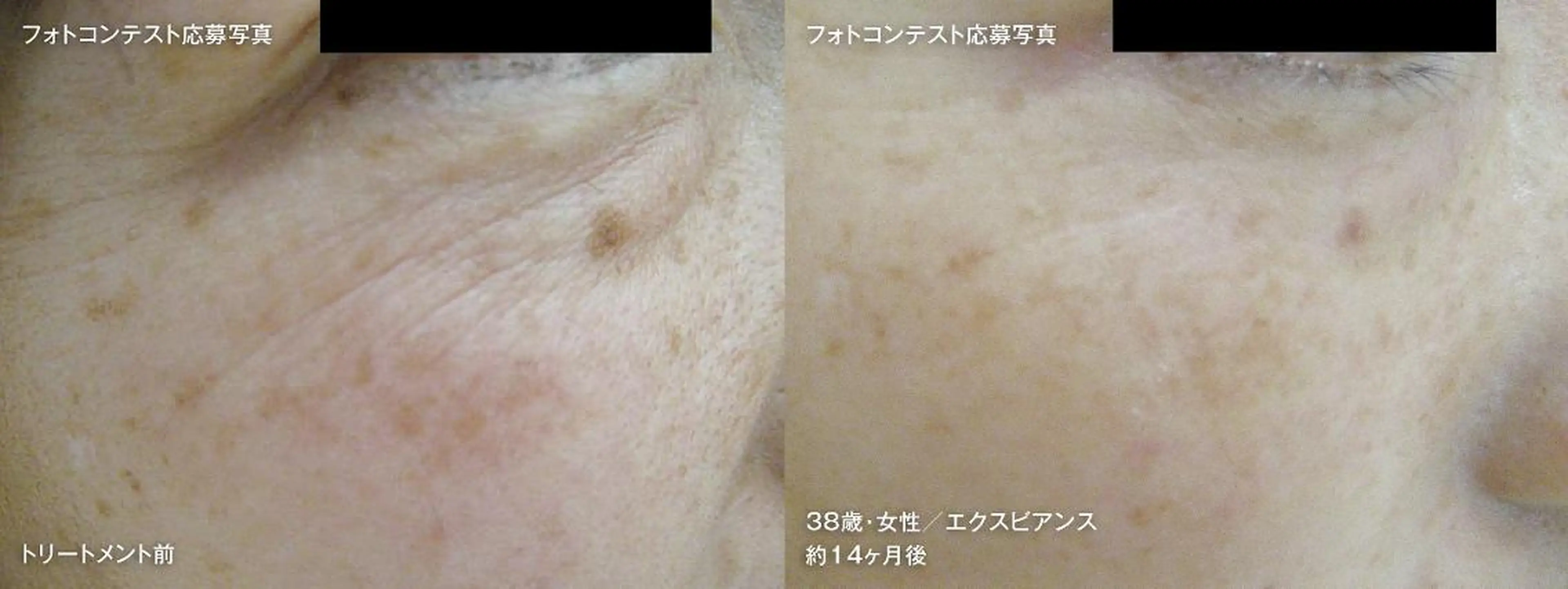 藤江 真弓のエステ・リラクイメージ