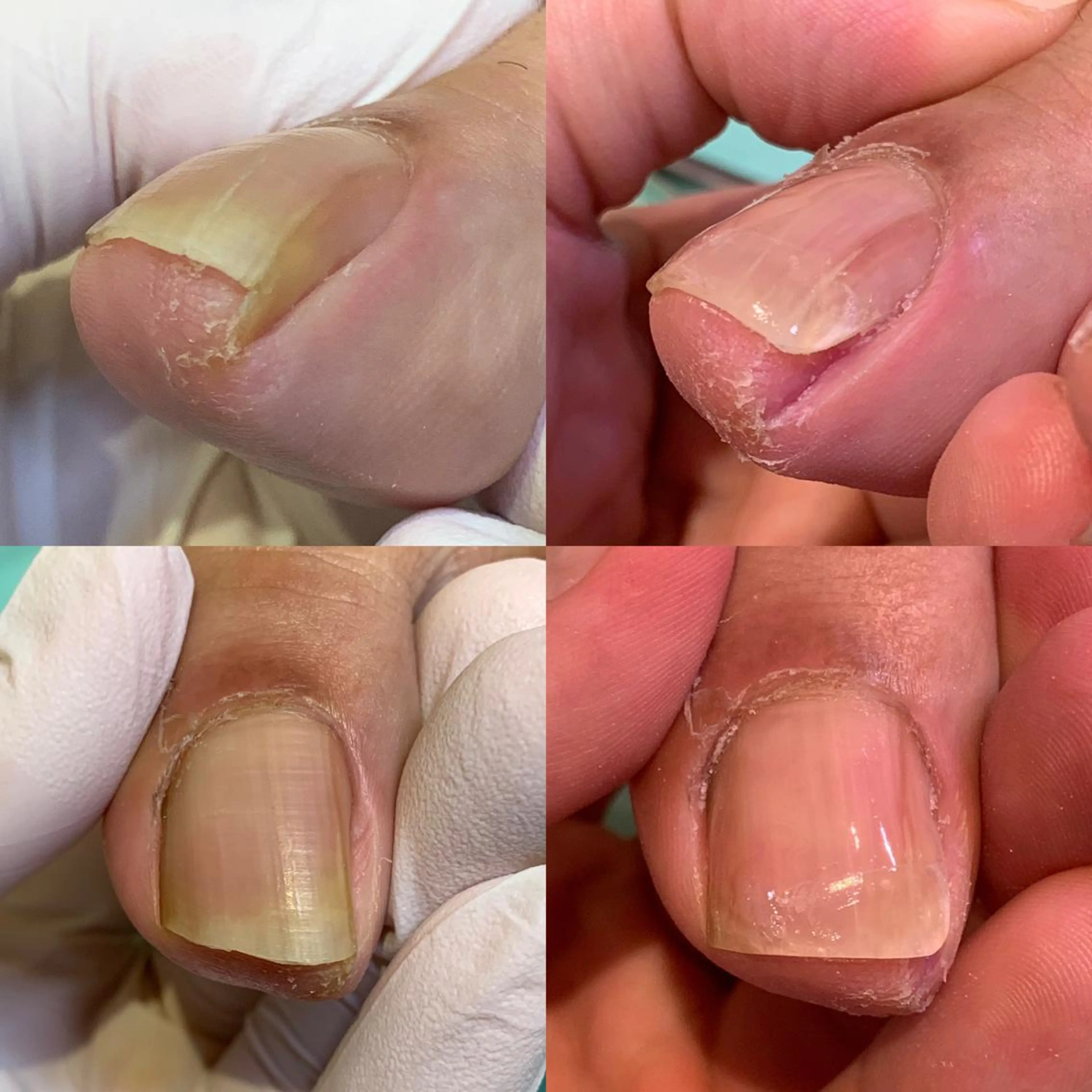 ネイル 東京巻き爪アカデミー所属・東京巻き爪 アカデミーのエステ・リラクイメージ