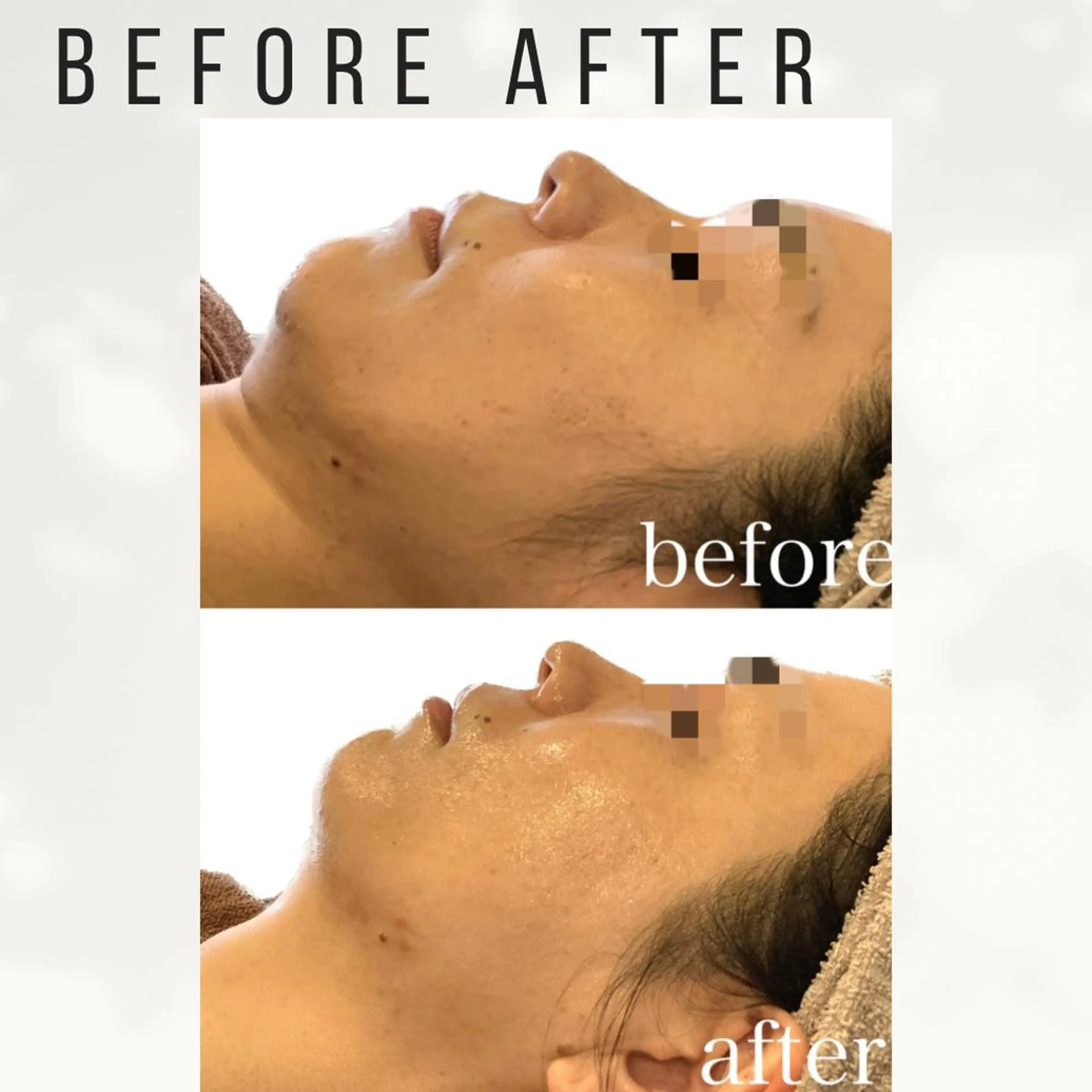 Beauty salon ハピー所属・大人女性のための 肌管理サロン　ハピーのエステ・リラクイメージ