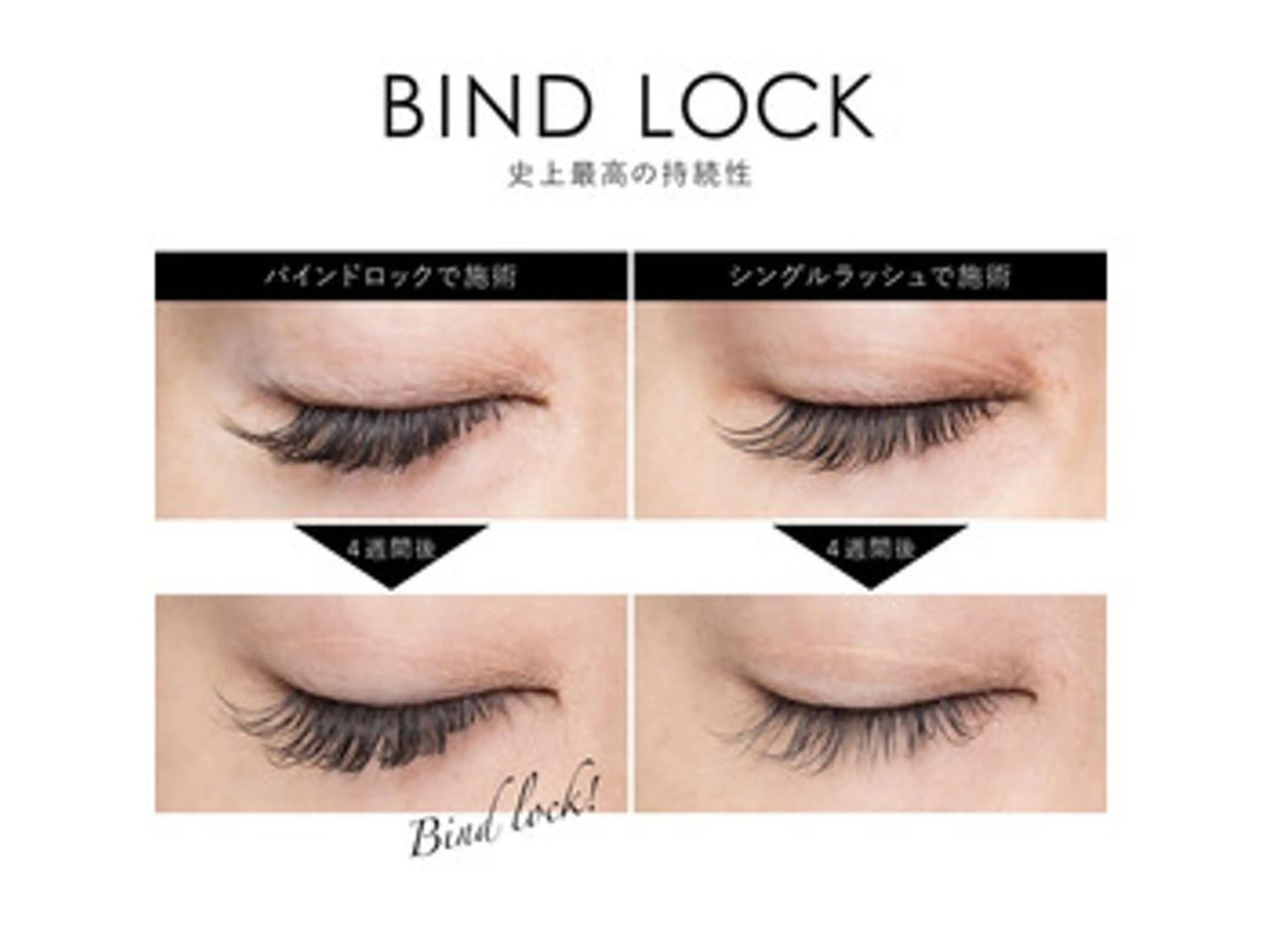 バインドロック100束の写真