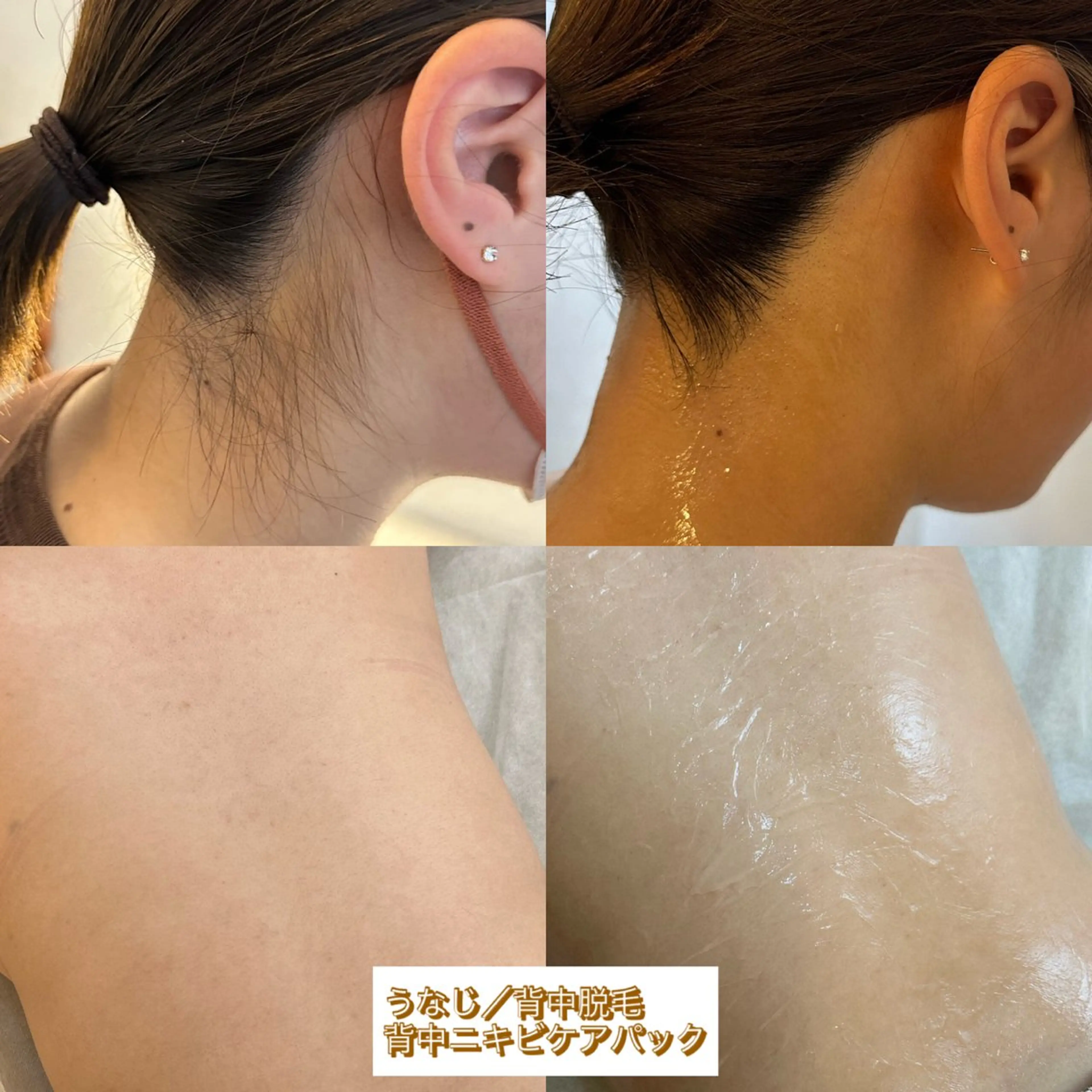 ハーブピーリング/韓国肌管理/フェイシャル/毛穴洗浄/眉毛/顔脱毛【糸脱毛専門】rev所属・ハーブピーリング🌹 毛穴洗浄❤️眉waxのエステ・リラクイメージ