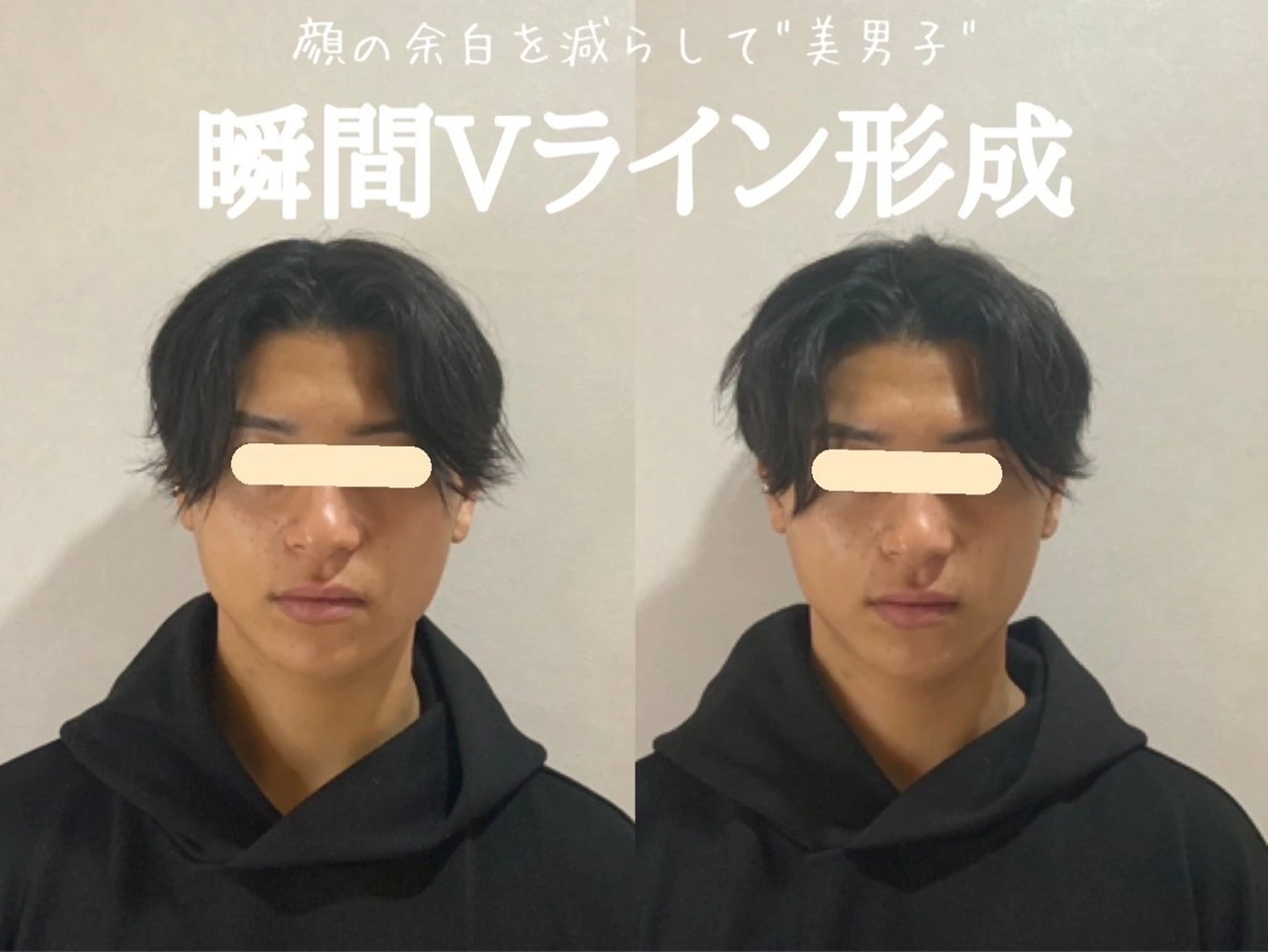 最速小顔・肌質管理 espoirマキのエステ・リラクイメージ