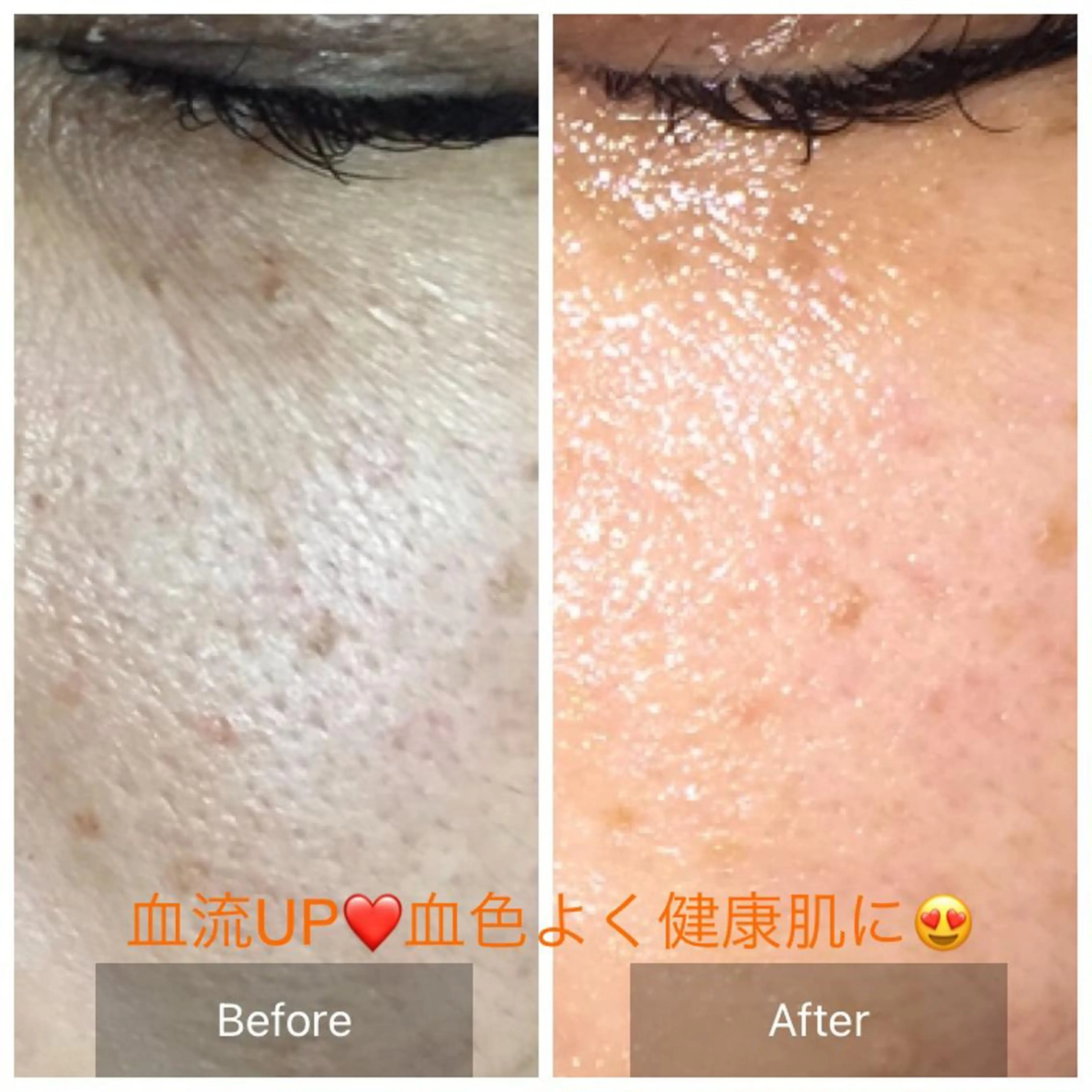 Mandarin Orange所属・毛穴から始める肌メン テマンダリンオレンジのエステ・リラクイメージ