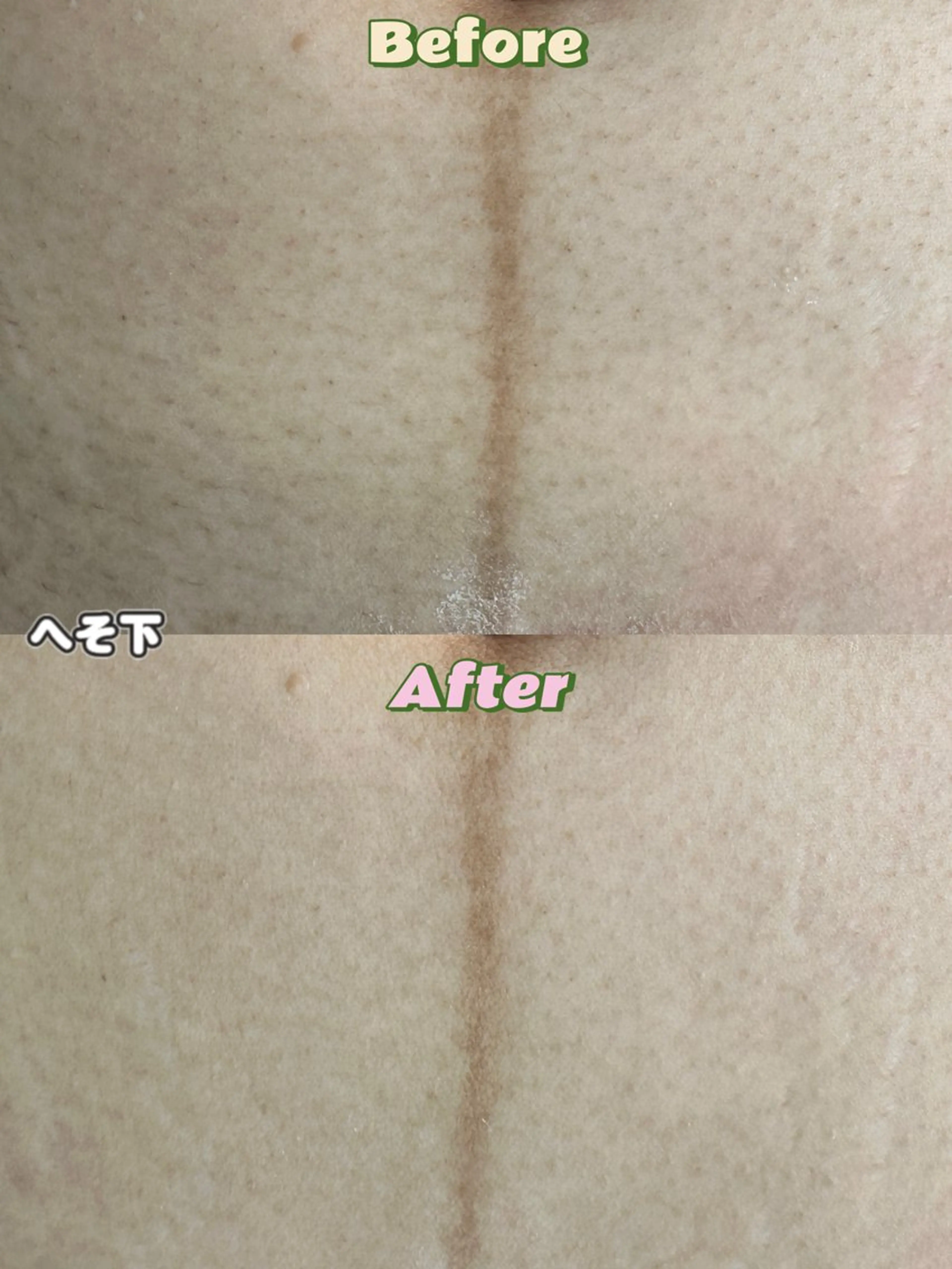 Hit. シュガーリング豊橋のエステ・リラクイメージ