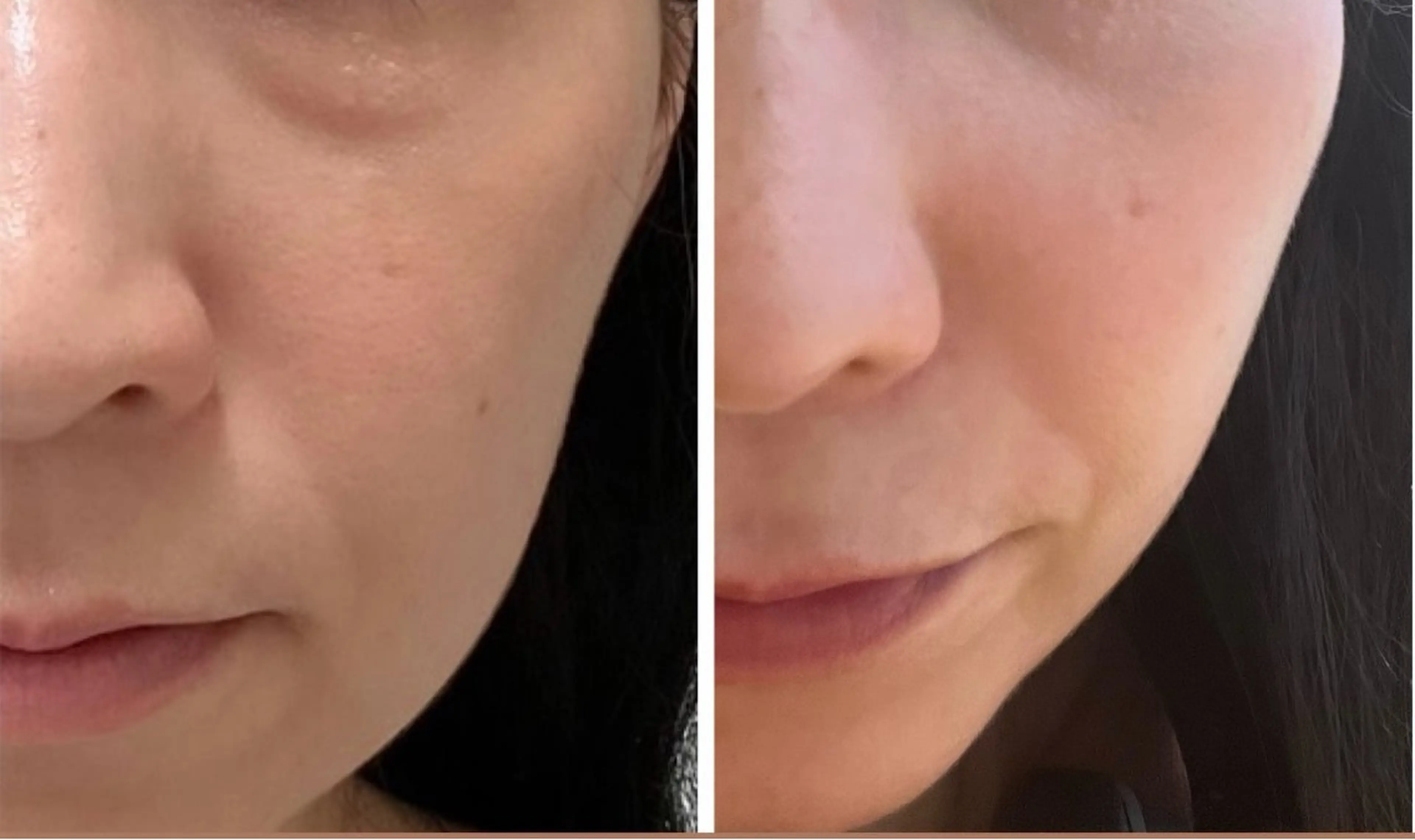 blossom山内店 (ブロッサム山内店)所属・la salon. chihoriのエステ・リラクイメージ